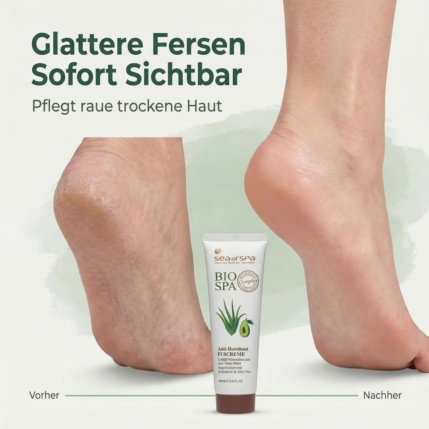 Dead Sea Foot Cream - Nourishing Moisturizer for Soft, Smooth Feet | 4.2 oz