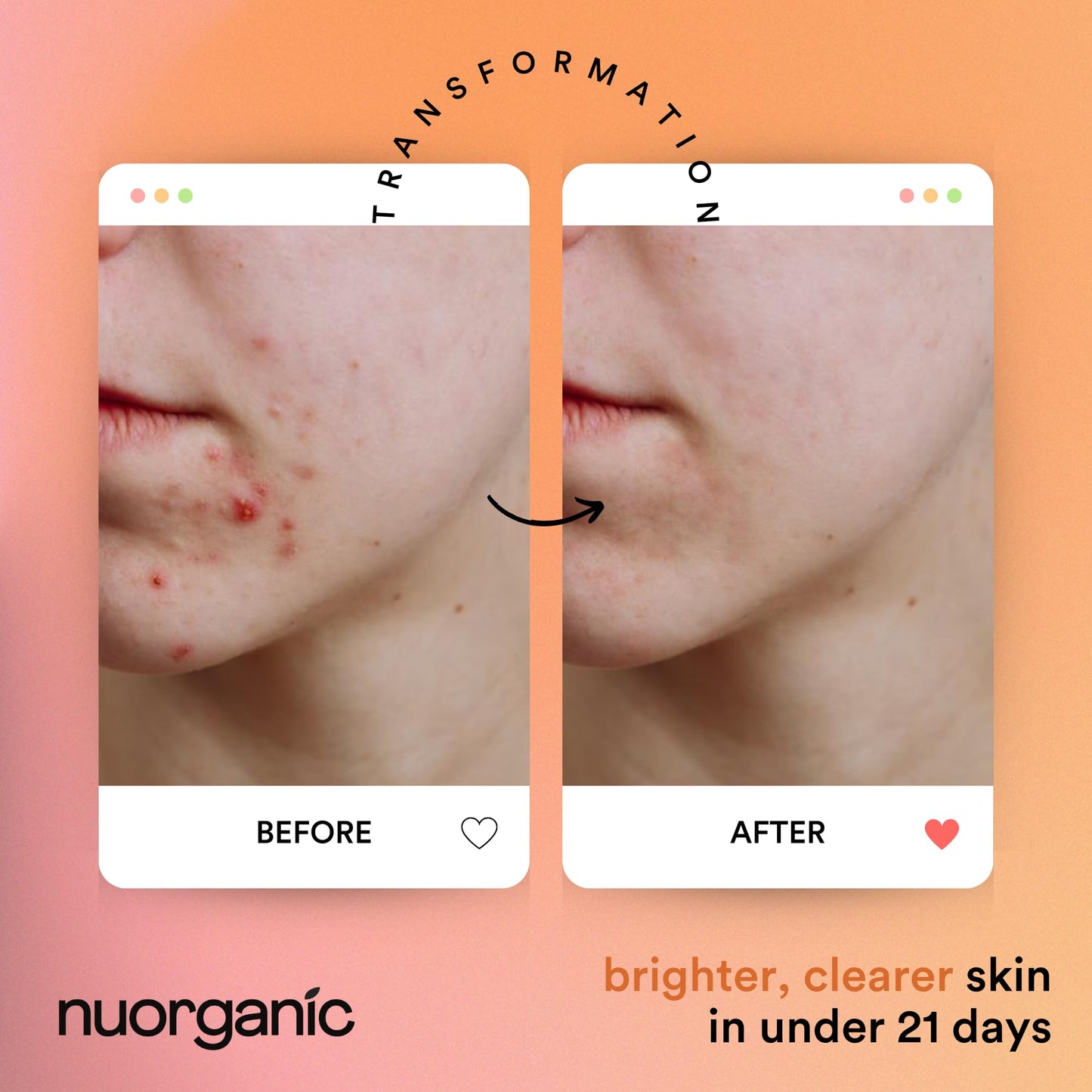 nuorganic Turmeric Face Mask - Soothing, Acne Clearing, Pore Refining, Exfoliating - New Airtight Squeezy Tube, Stays Fresh for 12 Months - Clean & Natural