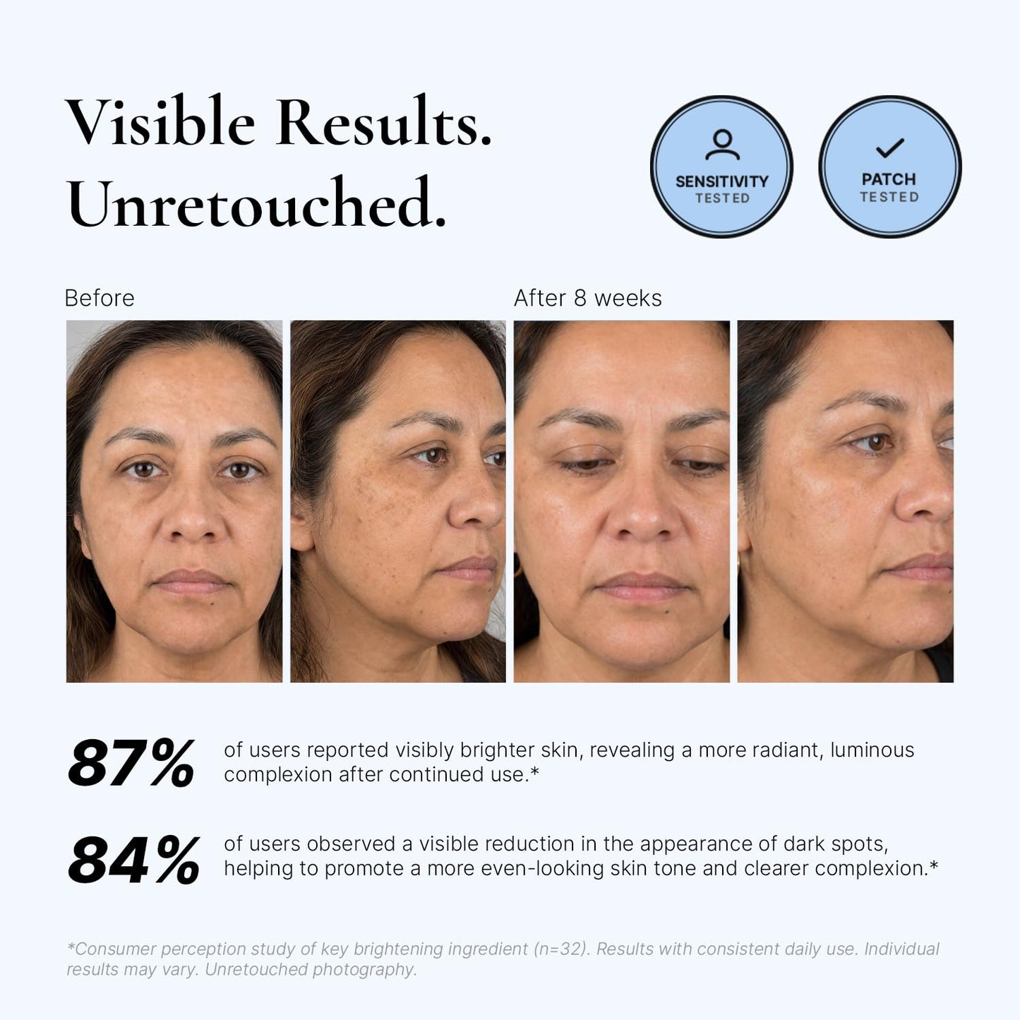 EnaSkin Dark Spot Corrector for Face & Body - 5% Tranexamic Acid, Niacinamide & Acid-Free Renewal Peptide - Hyperpigmentation, Melasma & Sun Spot Treatment, Gentle for Sensitive Skin, 1.01 fl oz