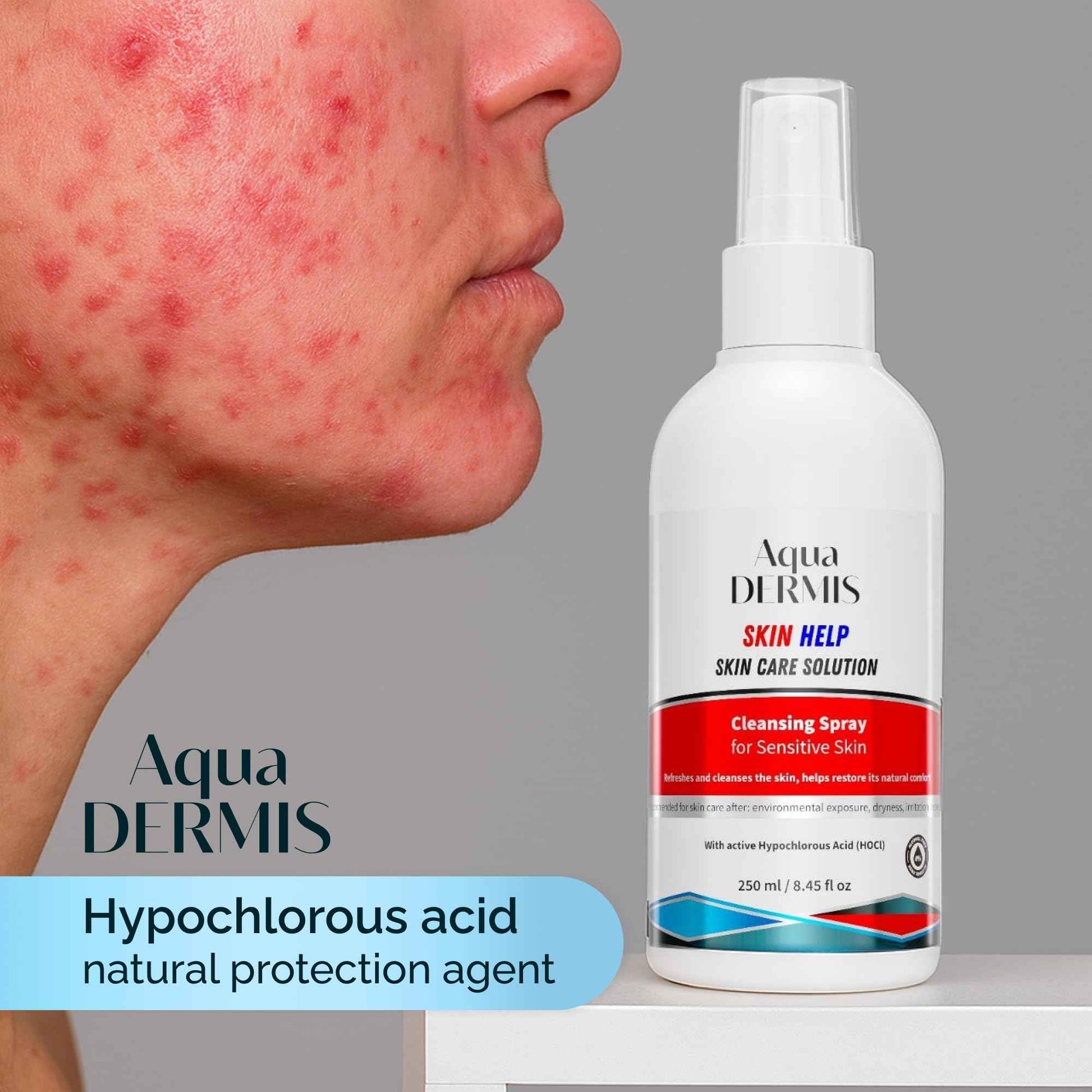 AquaDERMIS Skin Recovery Mist – Hypochlorous Acid Spray for Sensitive and Redness-Prone Skin – pH-Balanced, Alcohol-Free HOCl Facial Toner & Spray for Acne, Eczema, Aftercare – 45 fl oz (250ml)