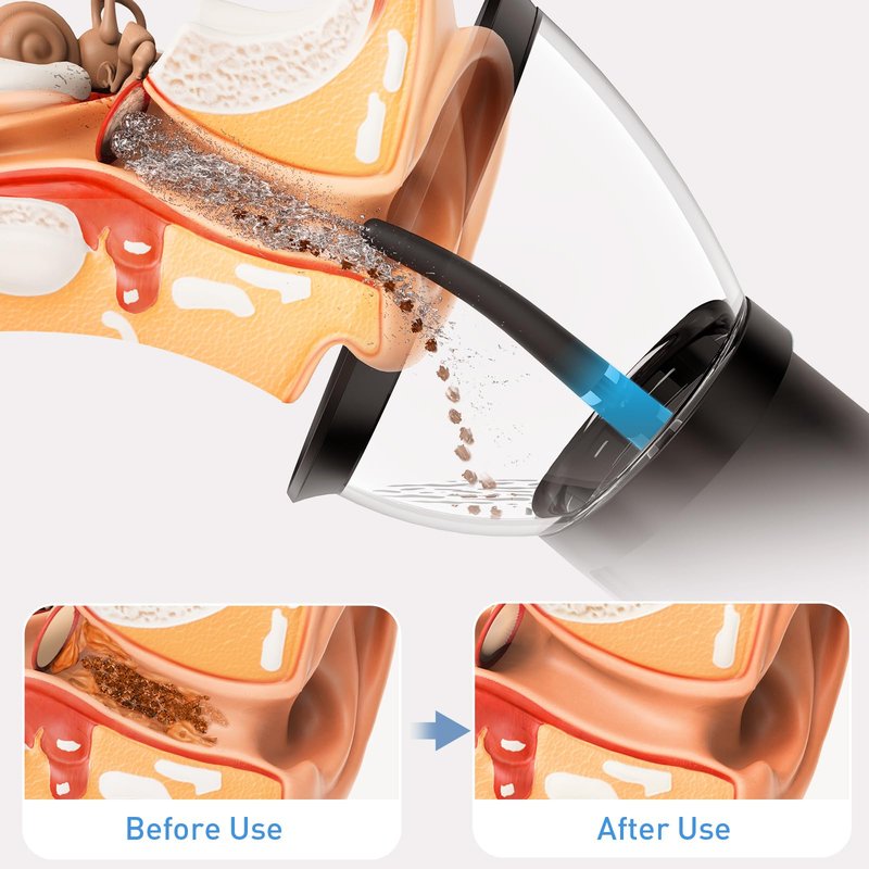 Ear Wax Removal-Electric Ear Cleaner, Retractable Ear Cleaning Kit, Safe Ear Wax Removal Tool, Effective Ear Irrigation Flushing System, Waterproof Ear Washer for Humans with 4 Pressure Modes
