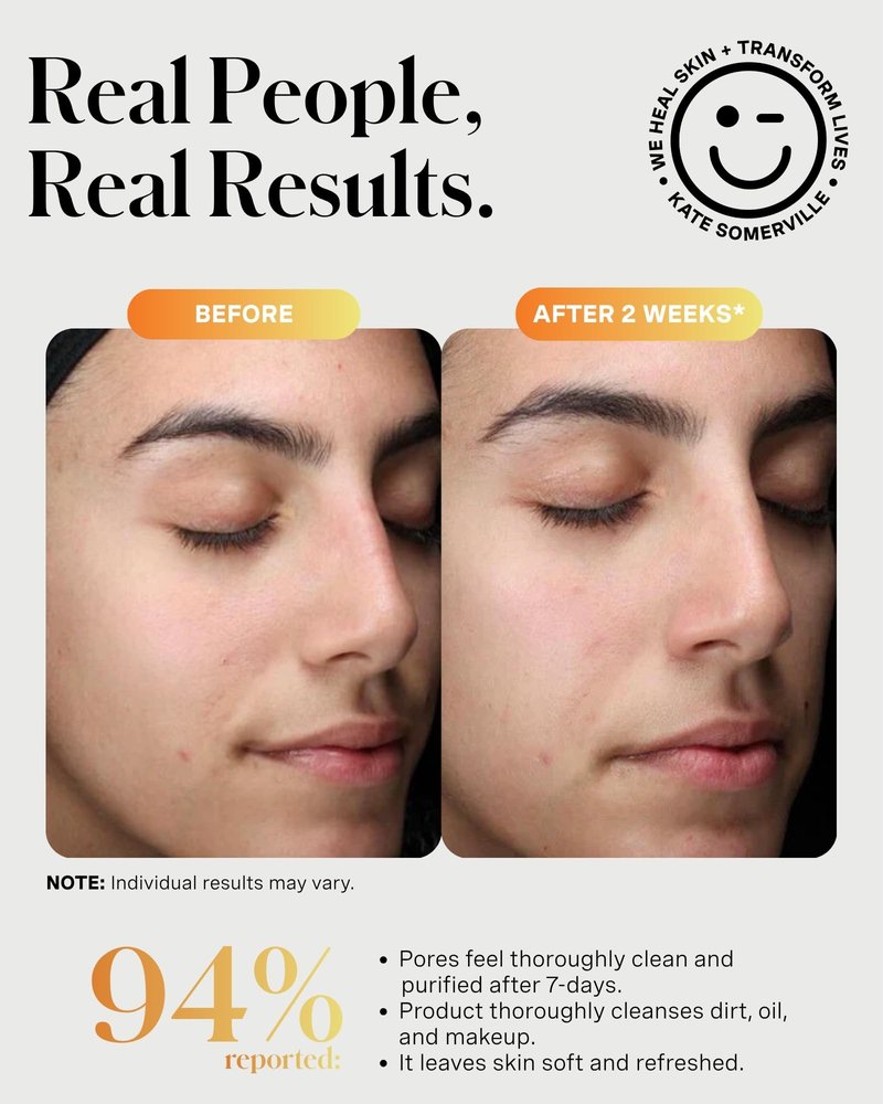 Kate Somerville ExfoliKate Cleanser – Daily Exfoliating Foaming Face Wash, Clinically Formulated Glycolic Acid and Lactic Acid Gentle Facial Scrub, 8 Fl Oz