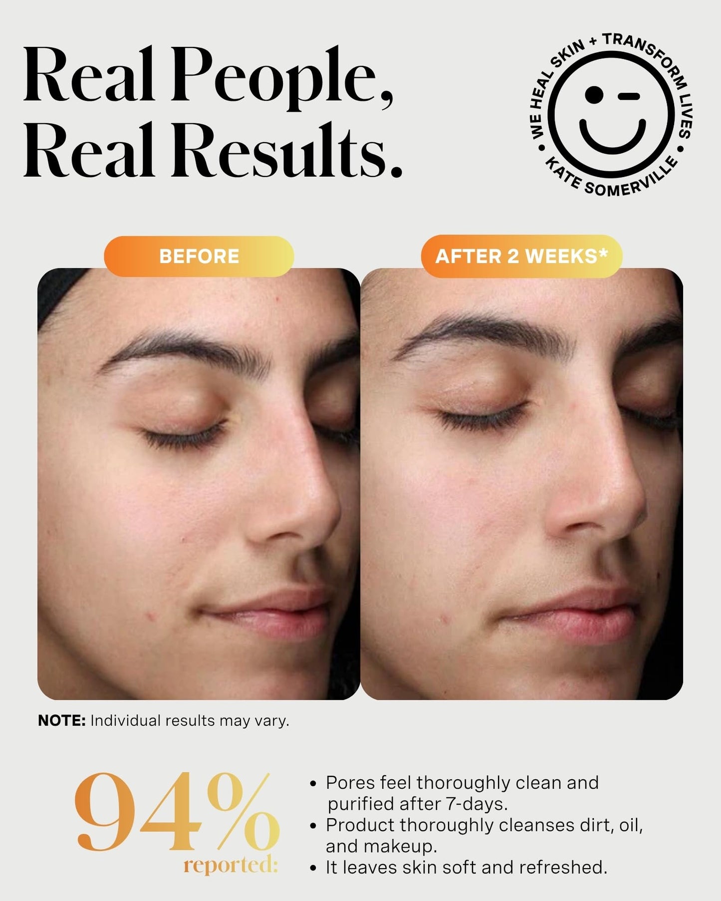 Kate Somerville ExfoliKate Cleanser – Daily Exfoliating Foaming Face Wash, Clinically Formulated Glycolic Acid and Lactic Acid Gentle Facial Scrub, 4 Fl Oz