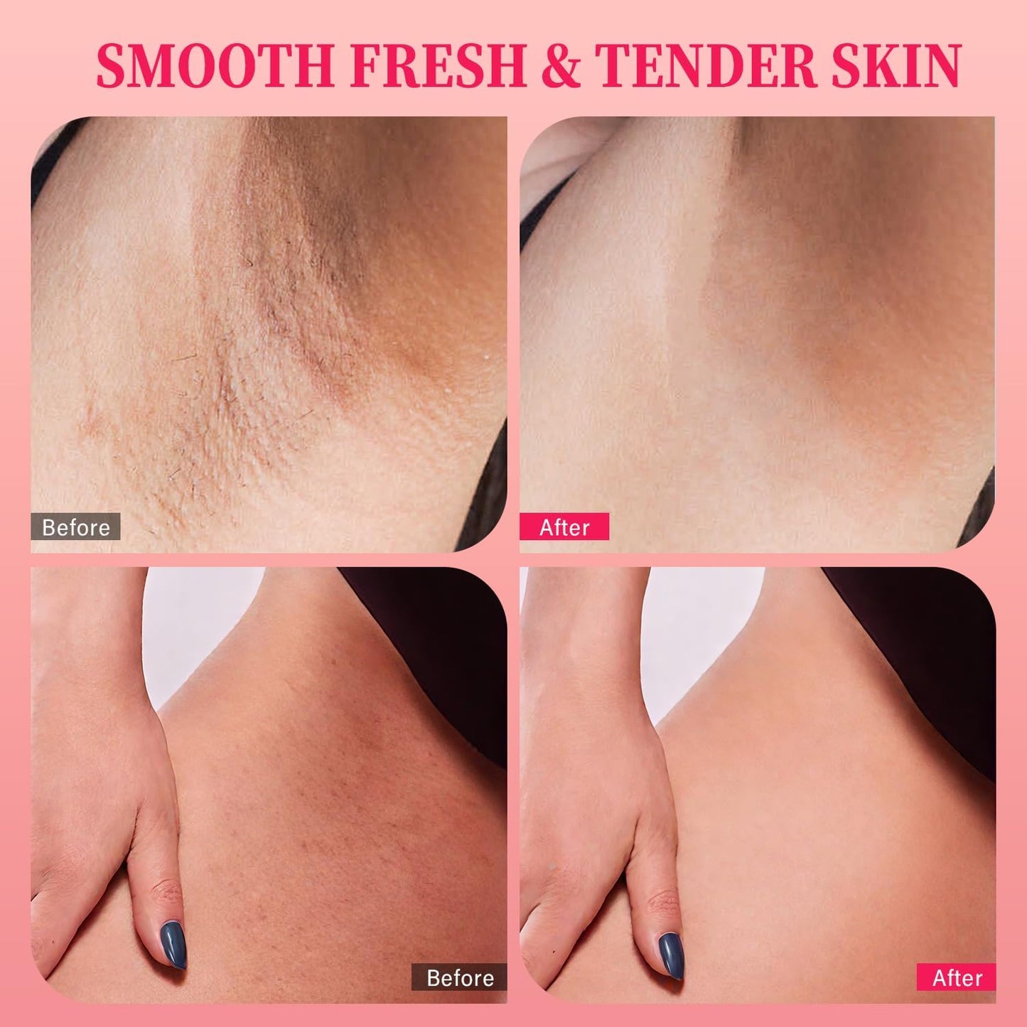 Bikini Area Exfoliator - 10% AHAs, BHA & Vitamin C Scrub for Ingrown Hair & Dark Spots | 7.76 oz