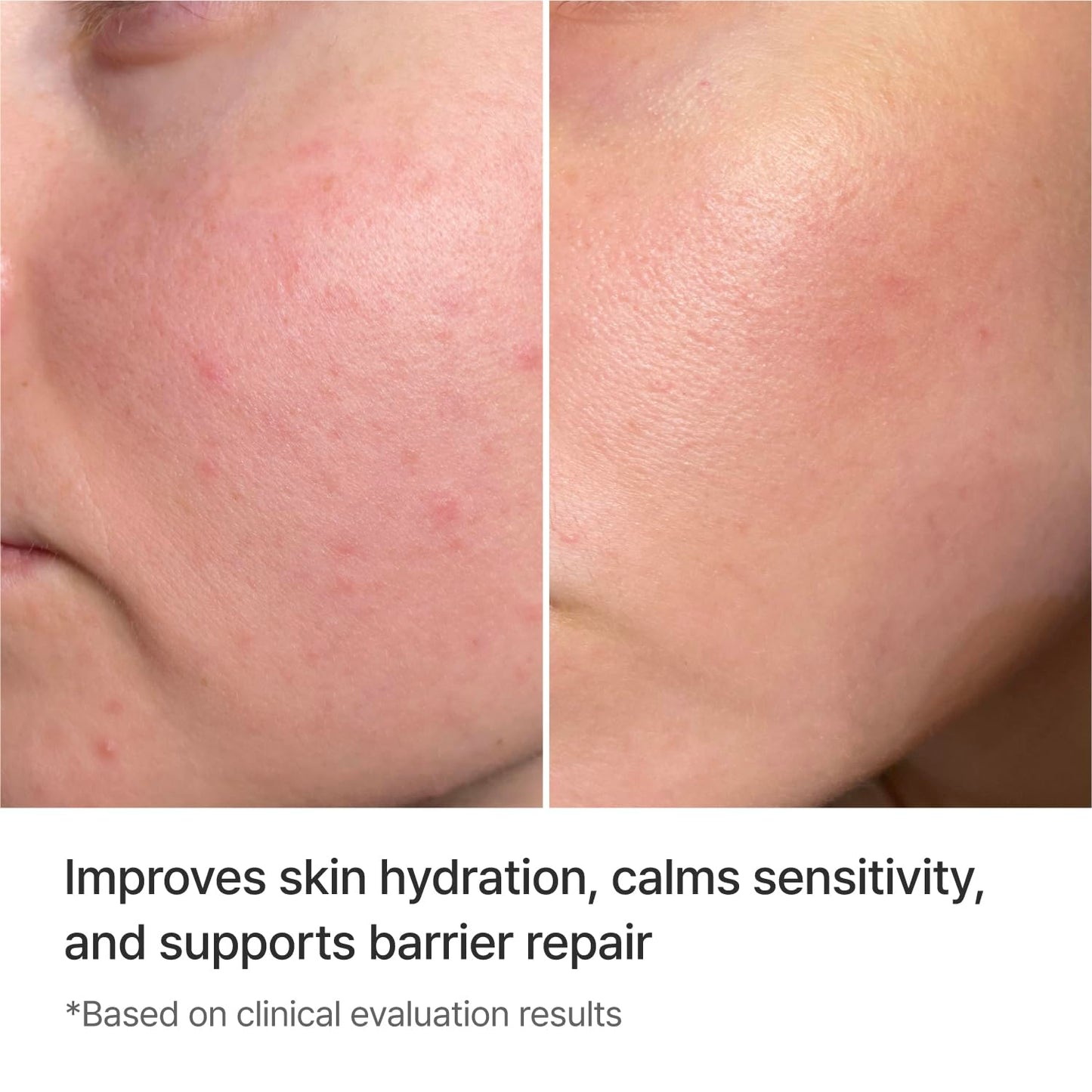 REJURAN® Moisture Treatment Essence, c-PDRN® - Hydrating Face Serum for Long-Lasting Moisture and Skin Barrier Support with PDRx (2.46 fl oz)