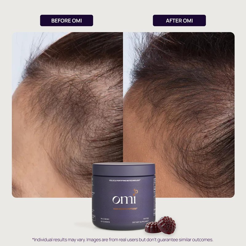 OMI - Peptides for Hair Growth, Gummies for Women with Patented Follicle Fortifying Biotechnology, Now in Delicious Wild Berry Flavor (60 Gummies)