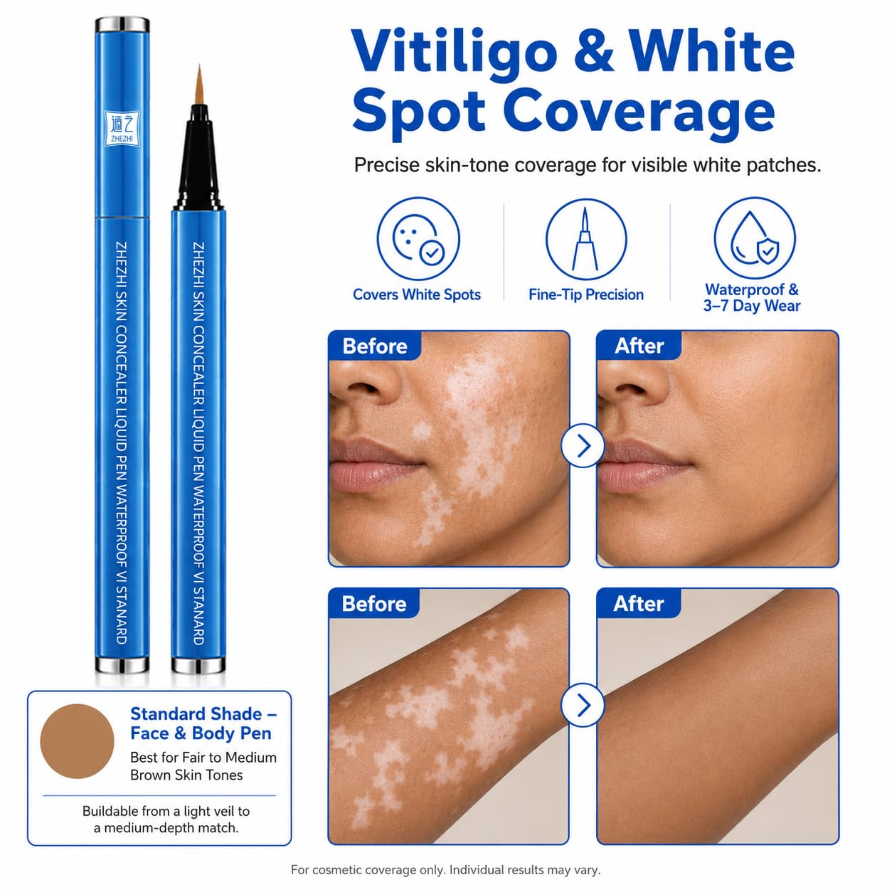 ZHEZHI Vitiligo Concealer Pen – Waterproof Face & Body Coverage for White Spots & Uneven Skin Tone, Long-Lasting & Sweatproof, Light to Medium Skin, 3.5g
