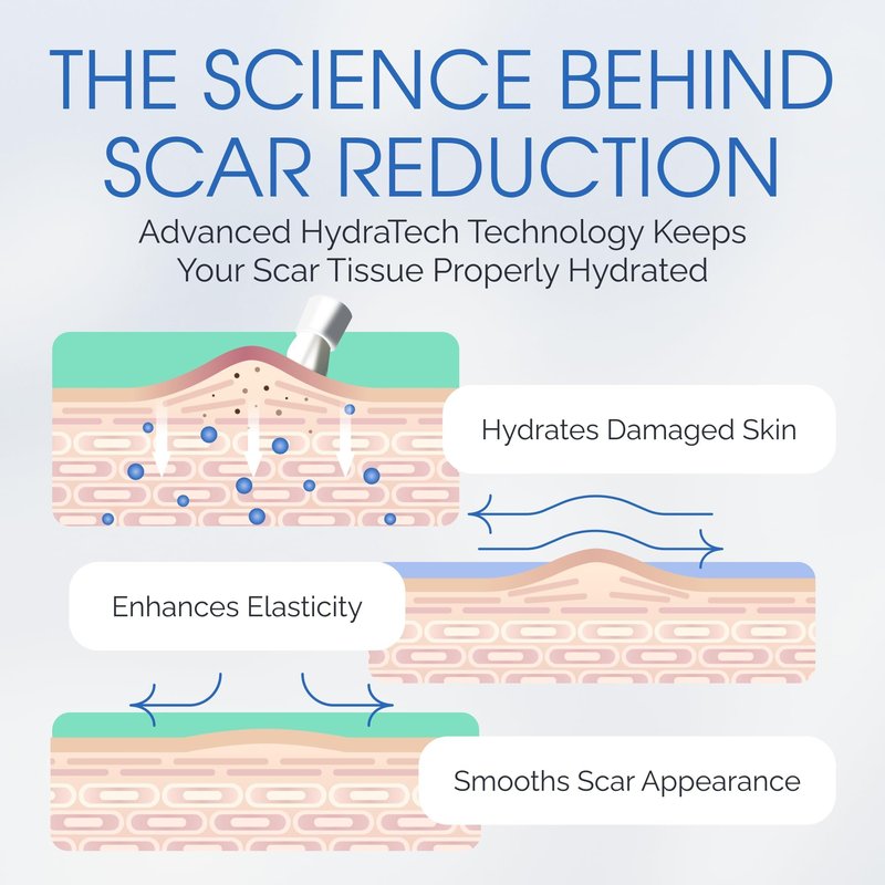 Brush On Medical Grade Silicone Scar Gel Wand for Facial Scars Post Procedure, Peel, Dermabrasion, Non-Comedogenic, Hypoallergenic. Soothe, Prevent, Repair and Restore Serum for Face