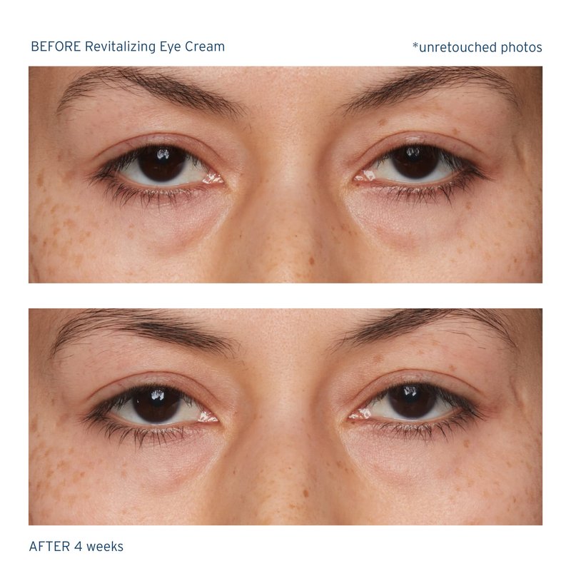 Santo Remedio, Piel Eterna, Revitalizing Eye Cream, Illuminating Eye Cream, Helps Reduce Dark Circles, Contains Marina Algae, Caffeine, Aloe, Hyaluronic Acid, Vitamin E, For All Skin Types, 1 Fl. Oz.