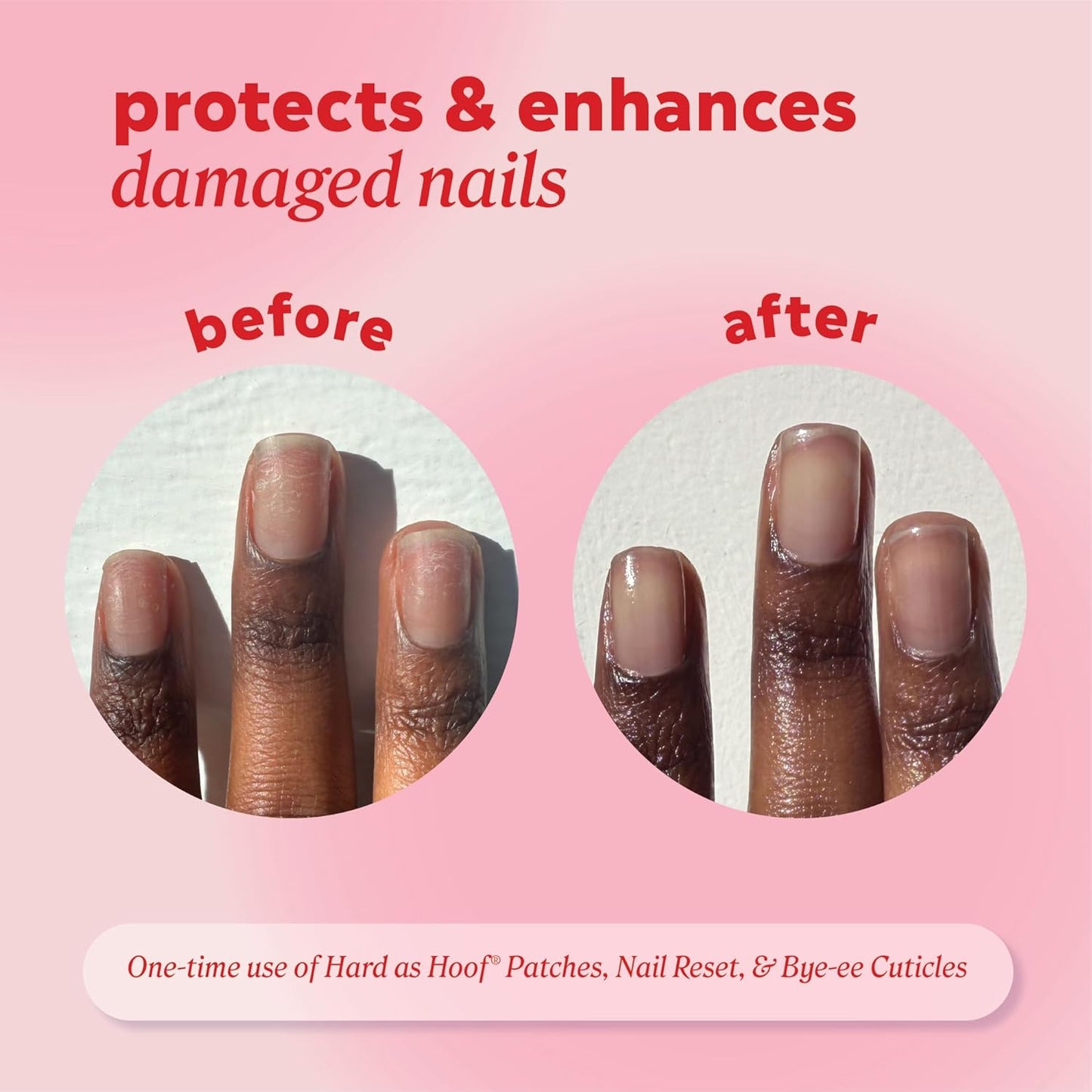 Onyx Nail Repair Patches - Strengthening Treatment for Nails & Cuticles | 20 Count