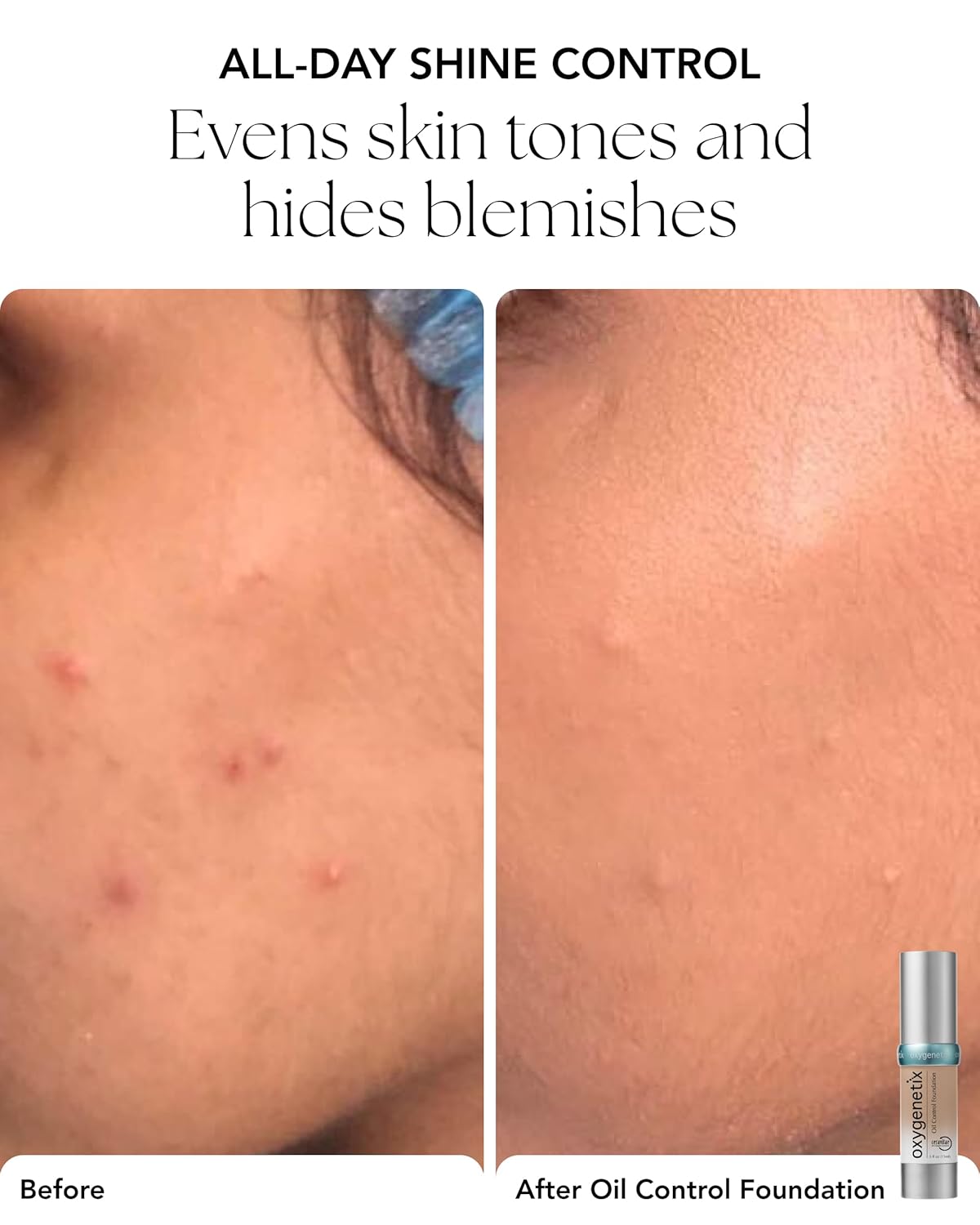 Oxygenetix Oil Control Foundation - Lightweight, Breathable Makeup for Oily Skin | Non-Comedogenic Coverage in Beige