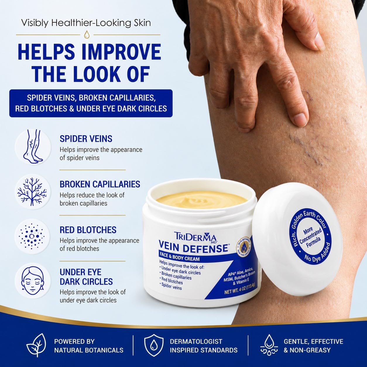 TriDerma Vein Defense Healthy Cream, Helps Improve the look of Spider Veins, Broken Capillaries, Red Blotches and Under Eye Dark Circles 4 oz