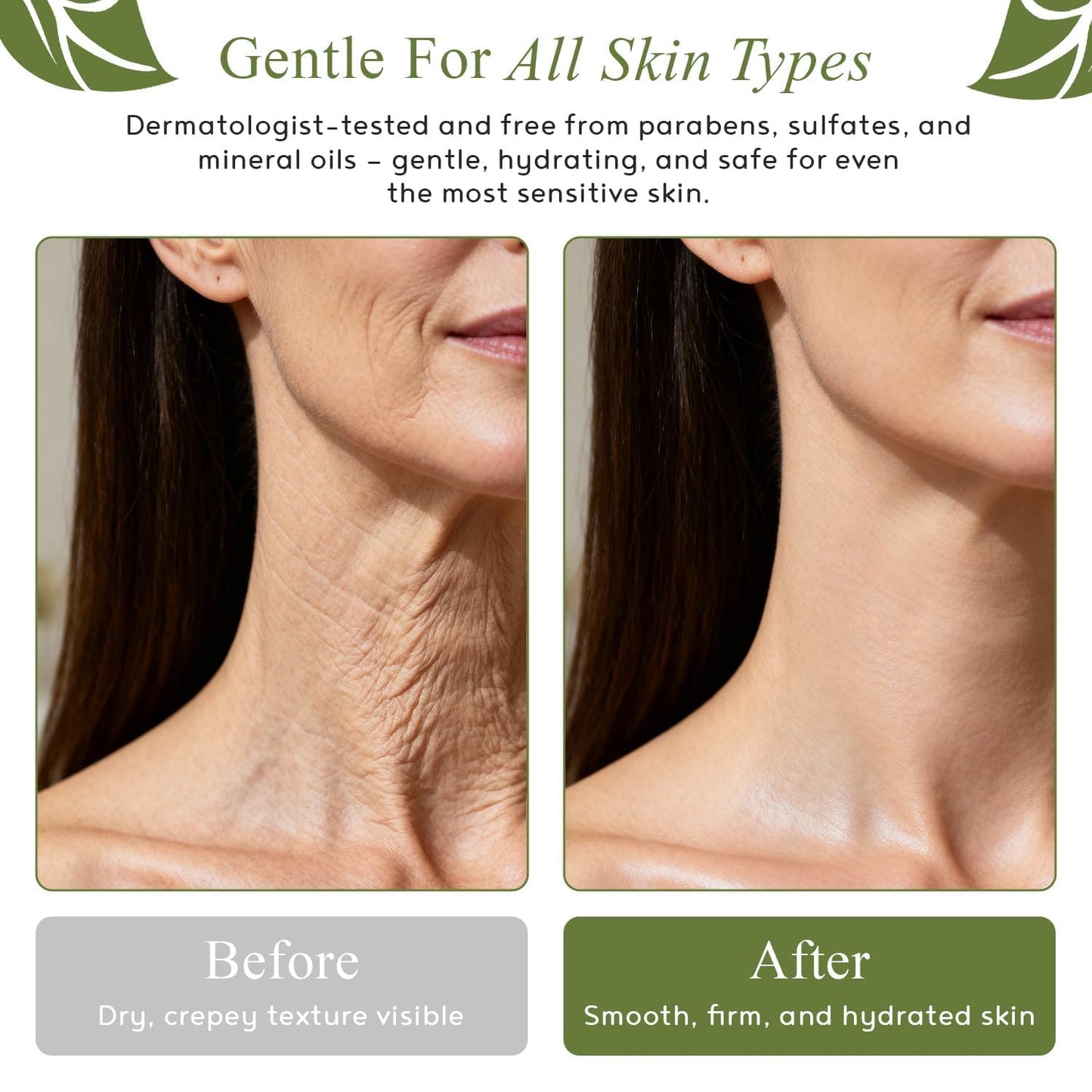 M.D. Blend Crepe-Ease Body Moisturizer Anti Aging Retinol Cream Firming, Smoothing & Hydrating Cream for Crepey Skin on Neck, Arms & Legs Crepe Skin Repair, Advanced Crepe Fix, 4 oz
