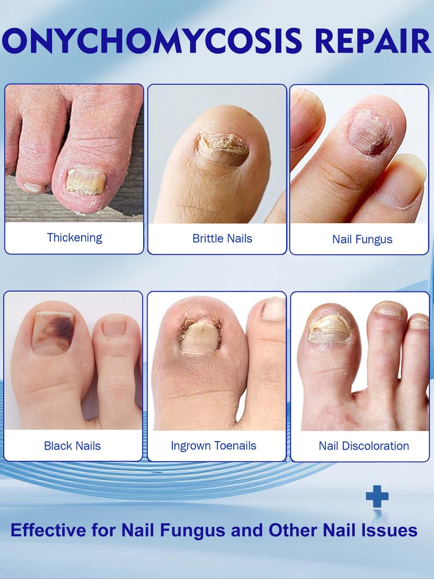 Nail Patches Toenail Treatment Extra Strength 8-Hour Overnight Nail Fast Acting Repair Effortless Hydrogel Nail Care and Repair for Damaged Nails Overnight Renewal for Men and Women (48 Count)