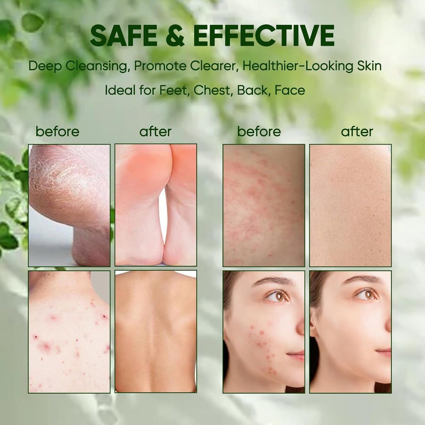 Tea Tree Soap Bar - Natural Handmade Deep Pore Cleansing with Tea Tree Oil & Coconut Oil | 3-Pack