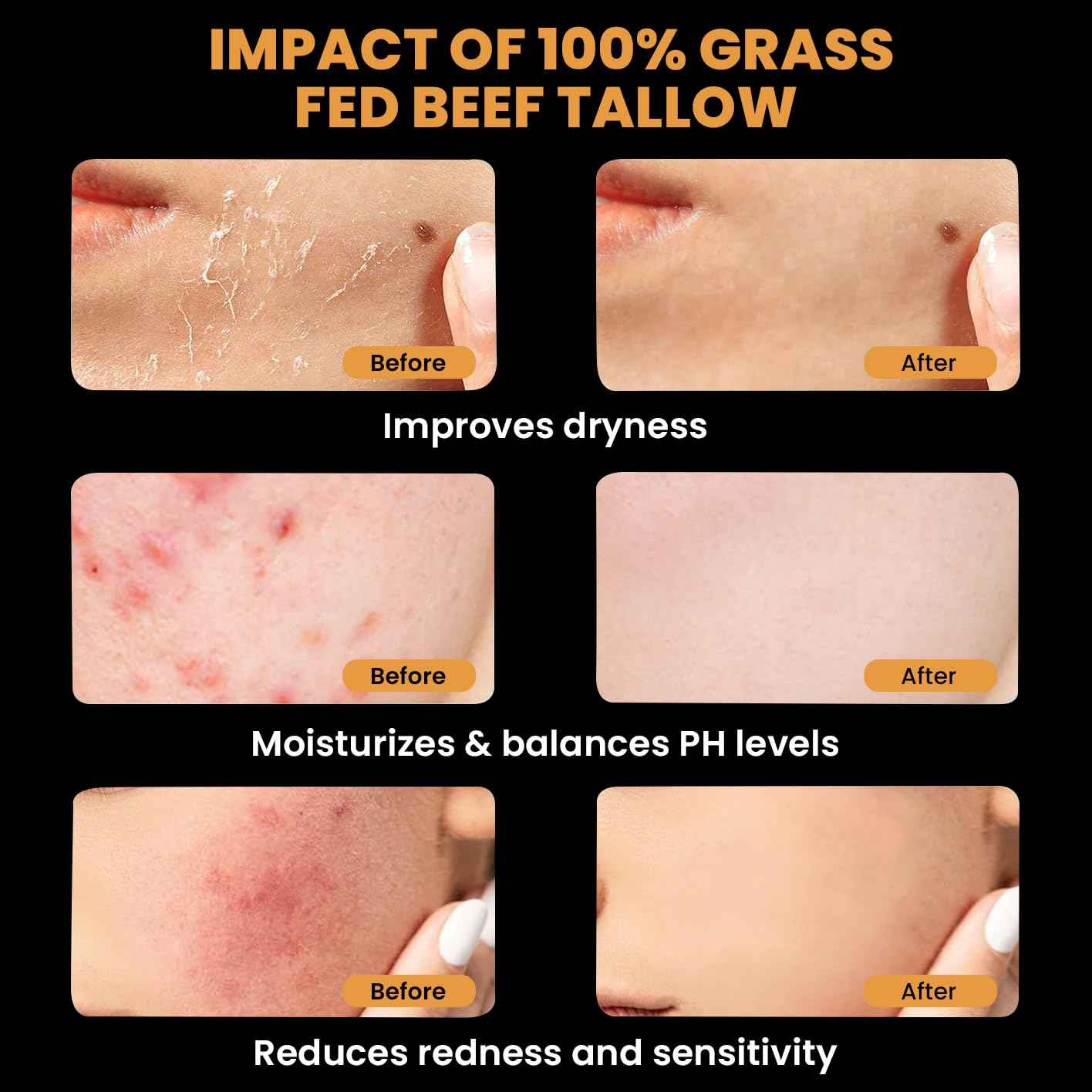 Tallow and Honey Balm for Face, Beef Tallow for Skin, Moisturizer with 100% Organic Grass-Fed Beef Tallow & Raw Wild Honey - Natural Formula for Dry & Sensitive Skin (Unscented)