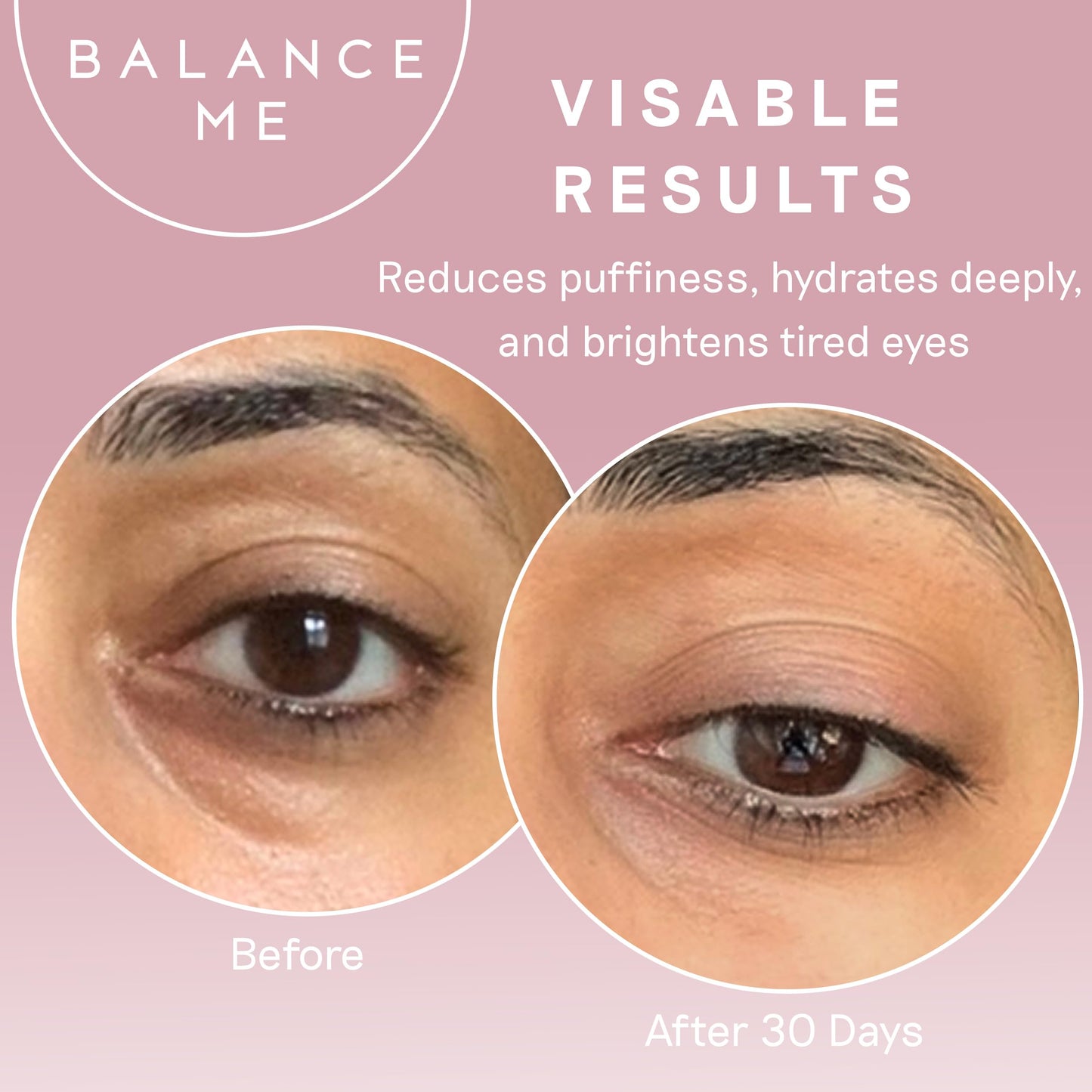Balance Me Wonder Eye Cream for Dark Circles, Puffy Eyes Treatment with Hyaluronic Acid, Witch Hazel & Cucumber Oil, Anti-Aging, Anti Wrinkle Eye Cream, (1 x 0.5 fl oz)