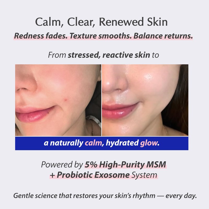 liv.reome MSM Sulfur-Derived Redness Recovery Cream for Sensitive, Thin Skin – Probiotic Exosome + Panthenol + Ceramide NP