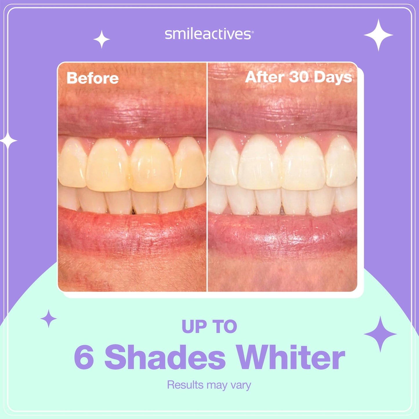 Smileactives Teeth Whitening Pen for White Smile, Fast Tooth Whitener and Stain Remover with Precision Brush Tip, Dental Quality Whitening Gel, Travel Pen, Easy to Use, Ultramint Flavor Flavor, 1 Pack