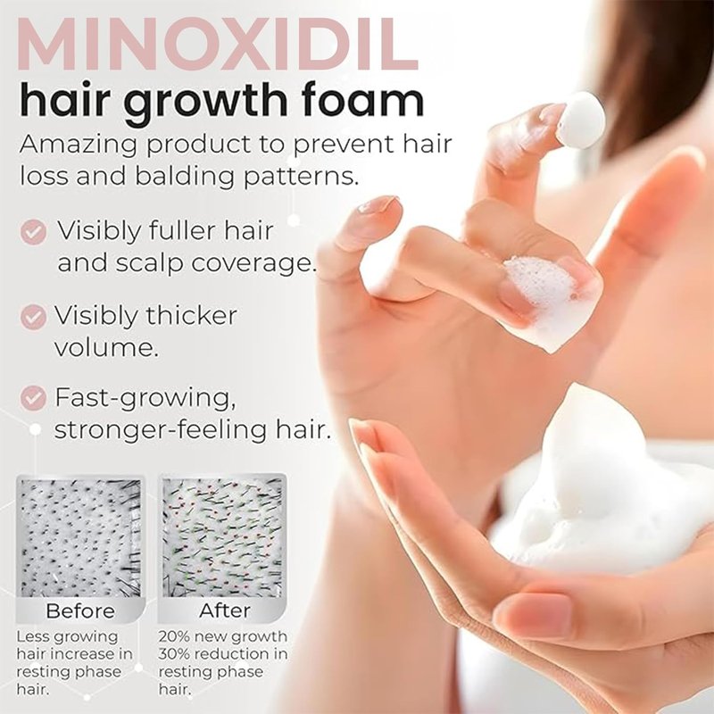Minoxidil for Women - 5% Hair Growth Foam | Unscented, Dermatologist Recommended | 3-Month Supply