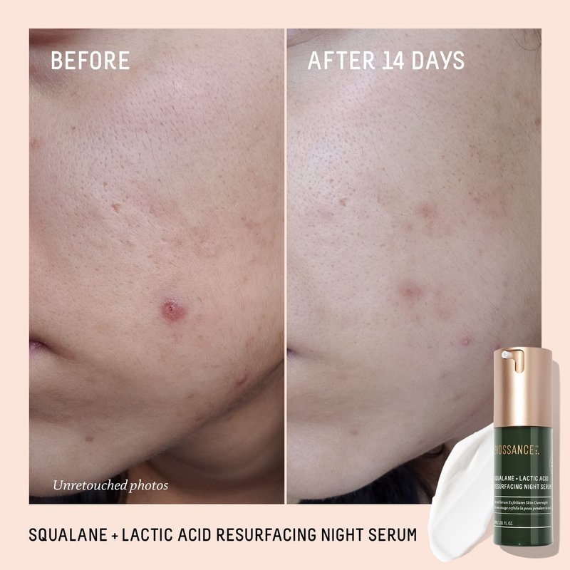 Biossance Squalane + Lactic Acid Resurfacing Night Serum - Vegan 10% Lactic Acid Face Serum for Skin Texture and Fine Lines - Gentle Night Exfoliant, Hydrating - Pore Reducer for Face, 1.0 Ounce