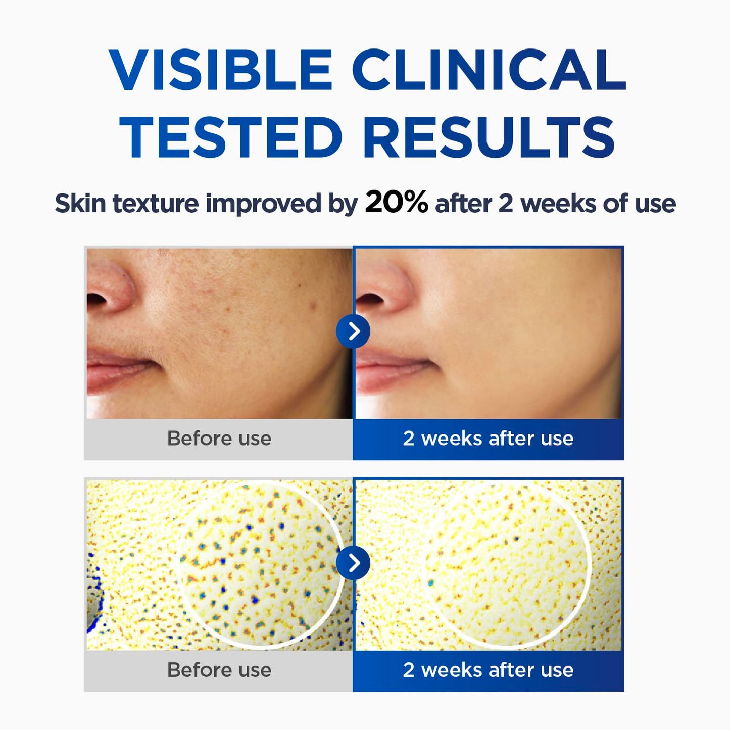 CKD Vita C TECA Toning Shot Serum – Vitamin C & TECA Face Serum for Brighter-Looking Skin, Hydrating Facial Serum for Radiant Complexion, Korean Skincare, 1.01 fl oz