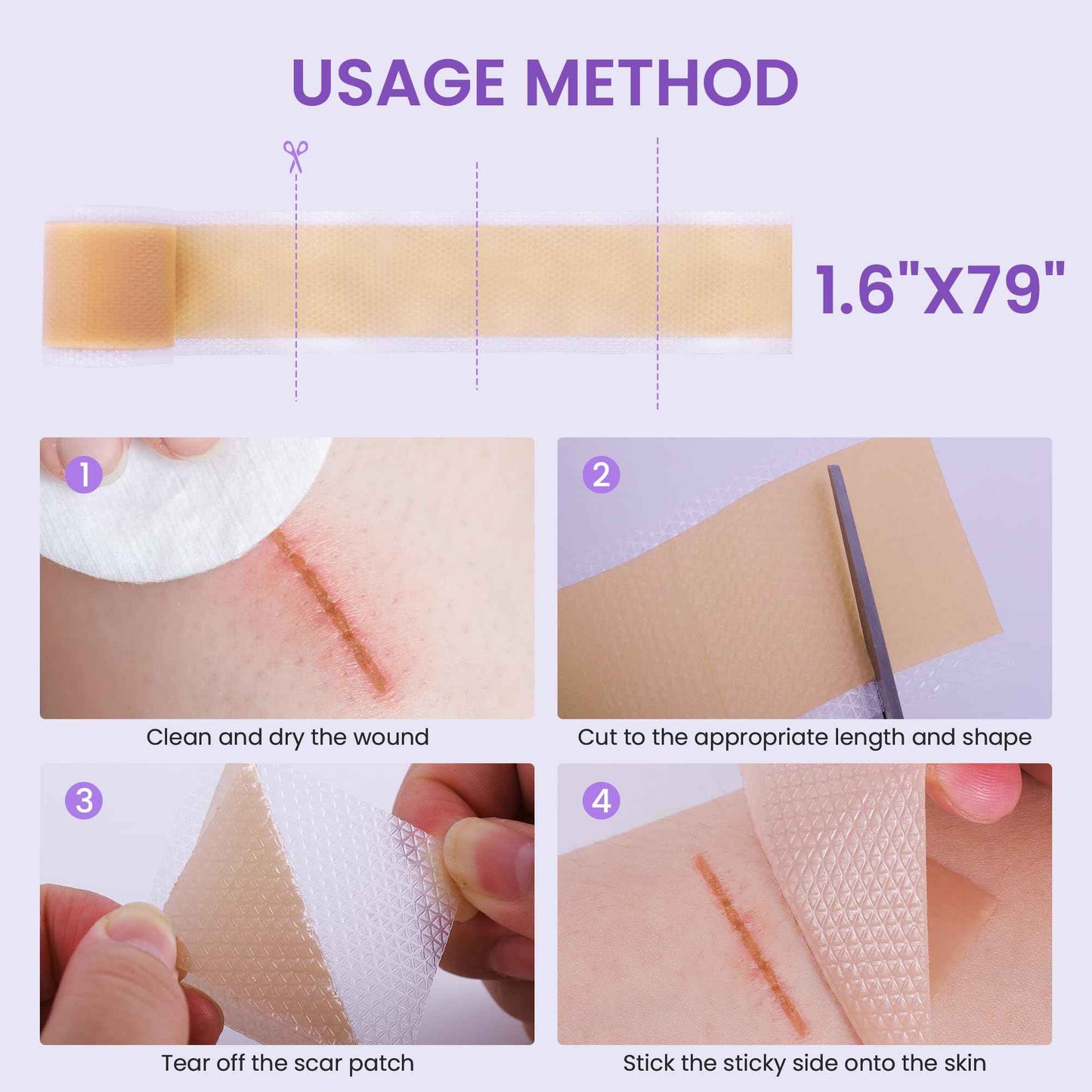 Antaly Silicone Scar Sheets, Silicone Scar Tape, Medical Grade Skin Patches for Surgical Scars, Keloid Bump Removal, C-Section, Stretch Marks, Hypertrophic, Post-Surgery-1.6"X 79" Roll, 2M