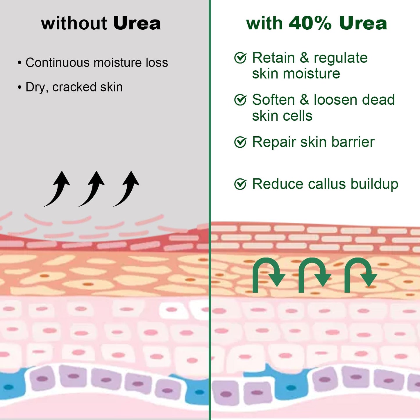 LEBARED Urea Cream 40 Percent For Feet Maximum Strength, Plus 2% Salicylic Acid with Hyaluronic Acid, Urea Foot & Hand Cream for Dry Cracked, 4.6 oz