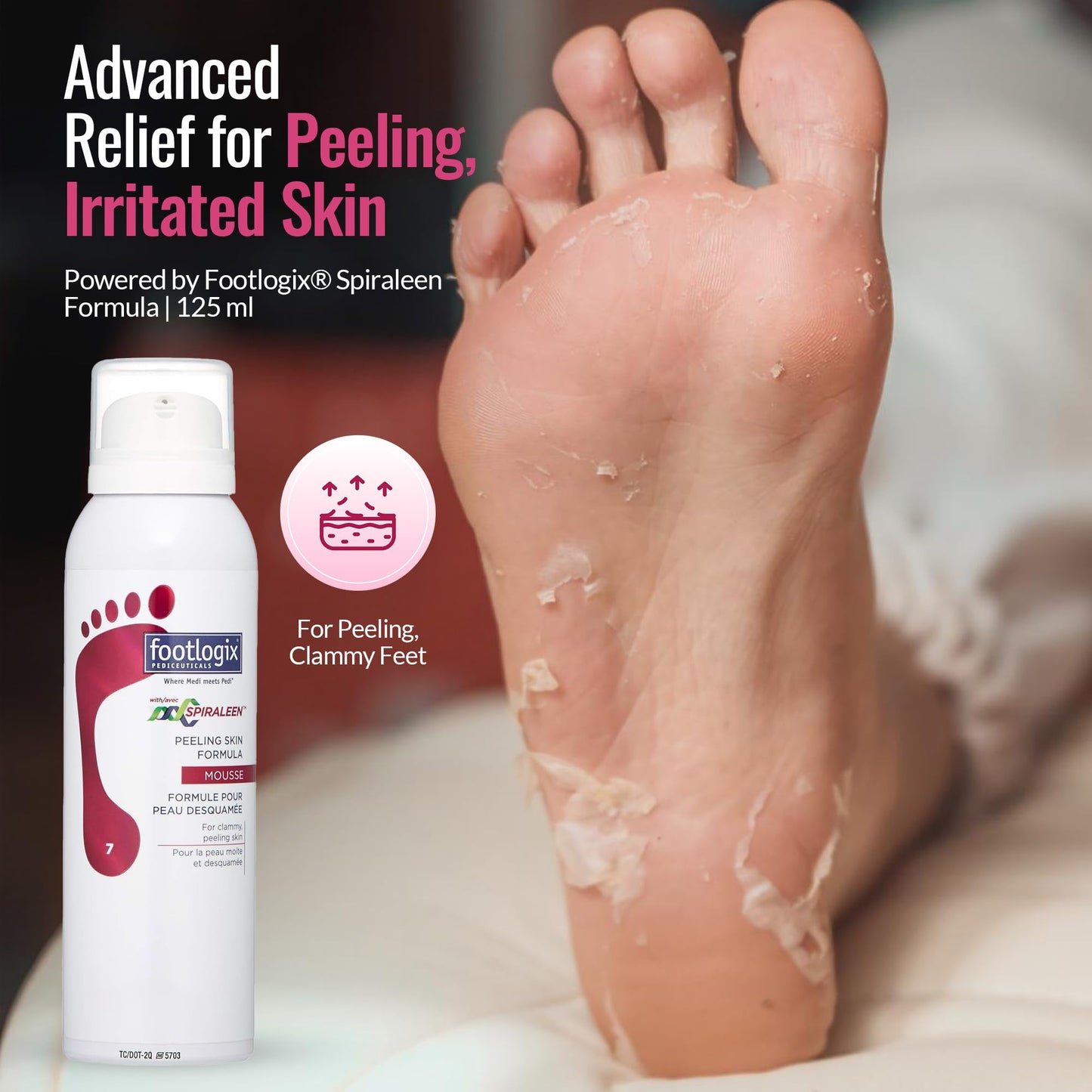 FOOTLOGIX Peeling Skin Formula with Spiraleen® 4.23 oz | Foot Care Mousse with Tea Tree Oil, Aloe Vera & Vitamin E | Lightweight Moisturizer for Dry Skin Between Toes | Pediceutical Formula