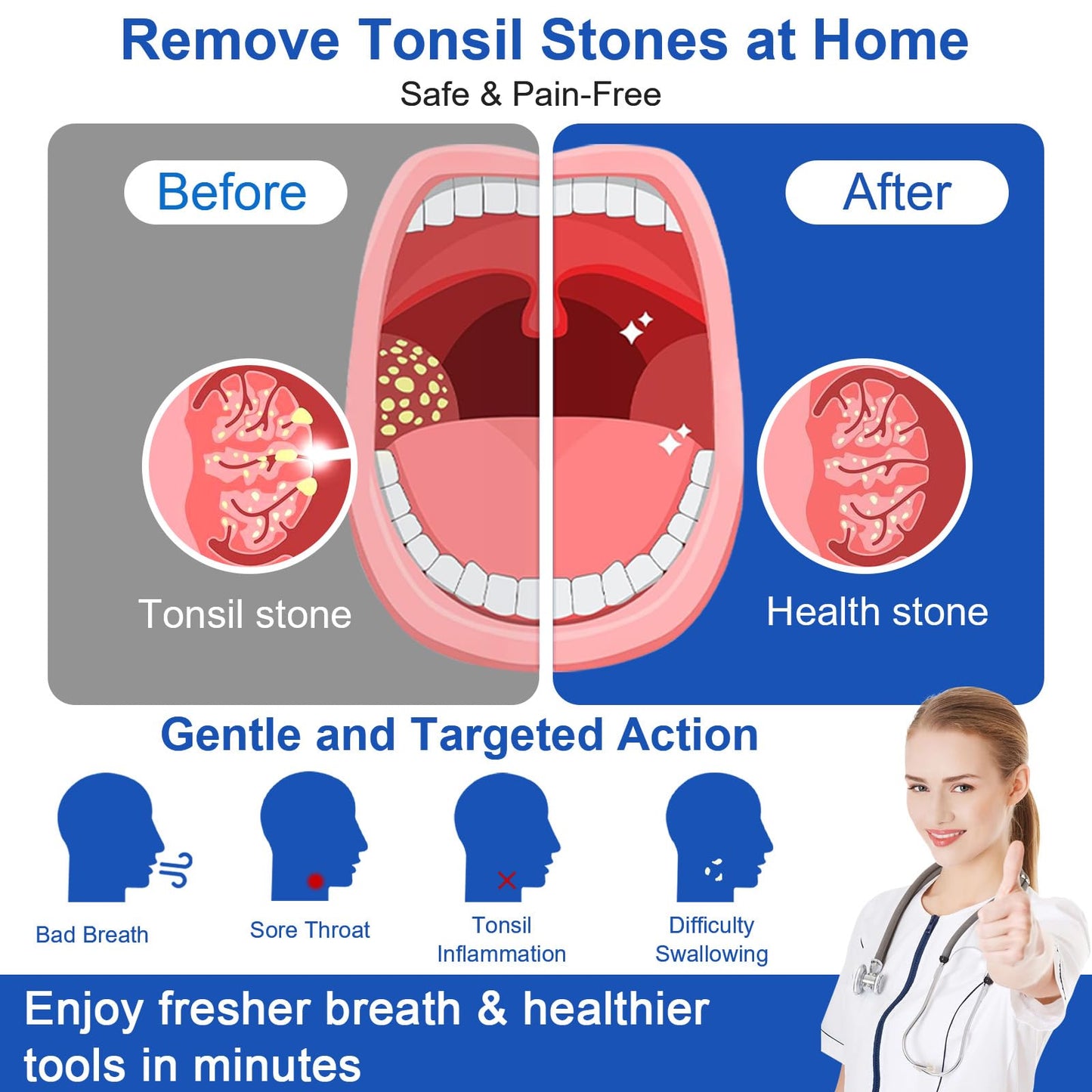 Tonsil Stone Vacuum Remover with LED Light Upgraded Electronic Oral Care Cleaning Tool Set 6 Suction Levels for Fresh Breath & Comfortable Use (White)