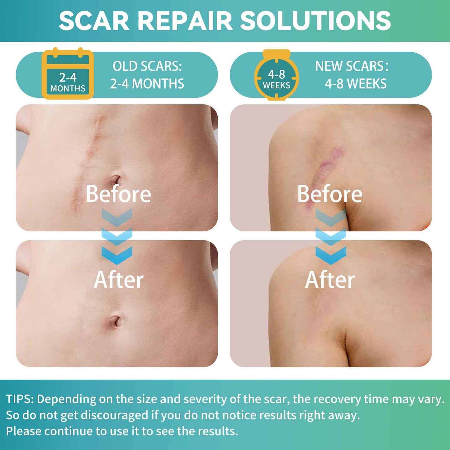 Silicone Scar Tape, Silicone Scar Sheets(1.6"X 120" Roll-3M), Reusable Medical Grade Silicone Tape for Scars, C-Section, Keloid, Acne, Tummy Tuck, Surgical Scars, Light