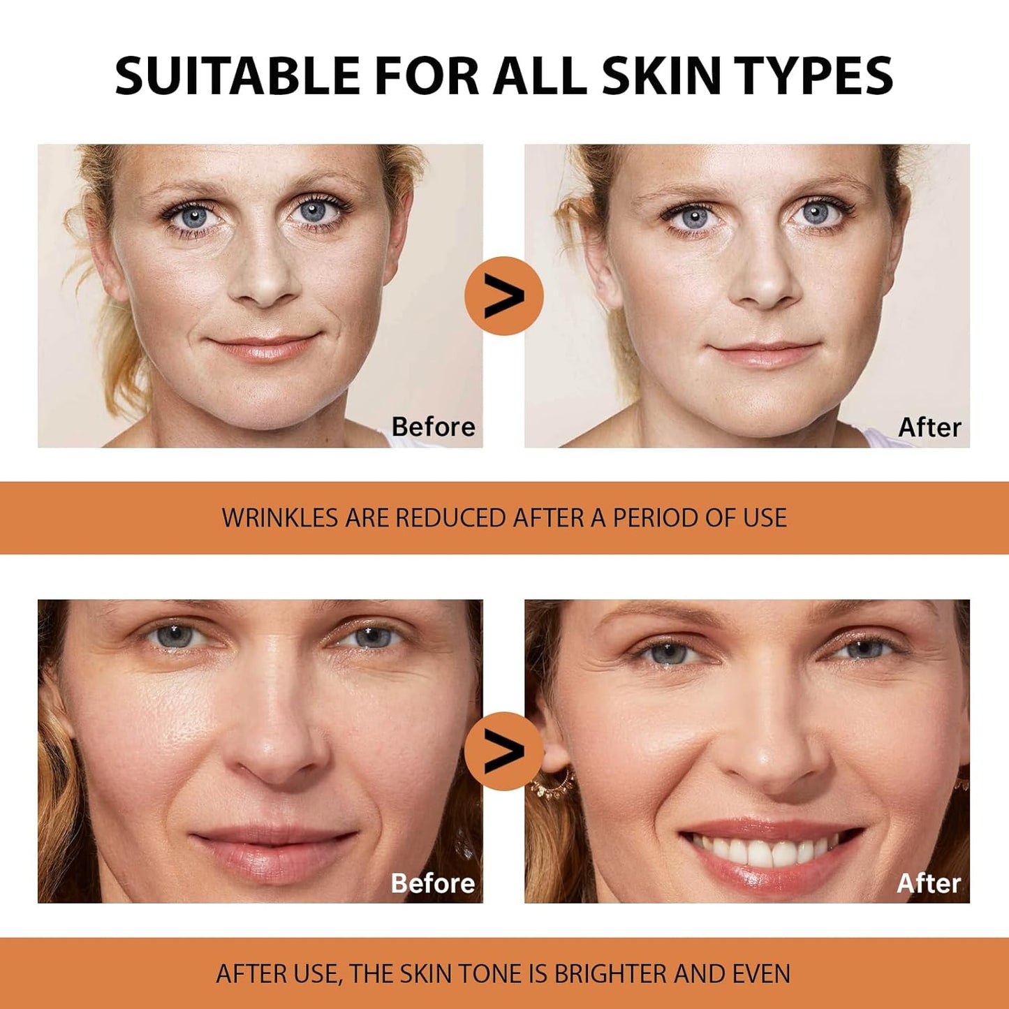 Vitamin C Serum for Face - Anti-Aging with Hyaluronic Acid & Vitamin E | Deep Hydration, 2.02oz / 60ml