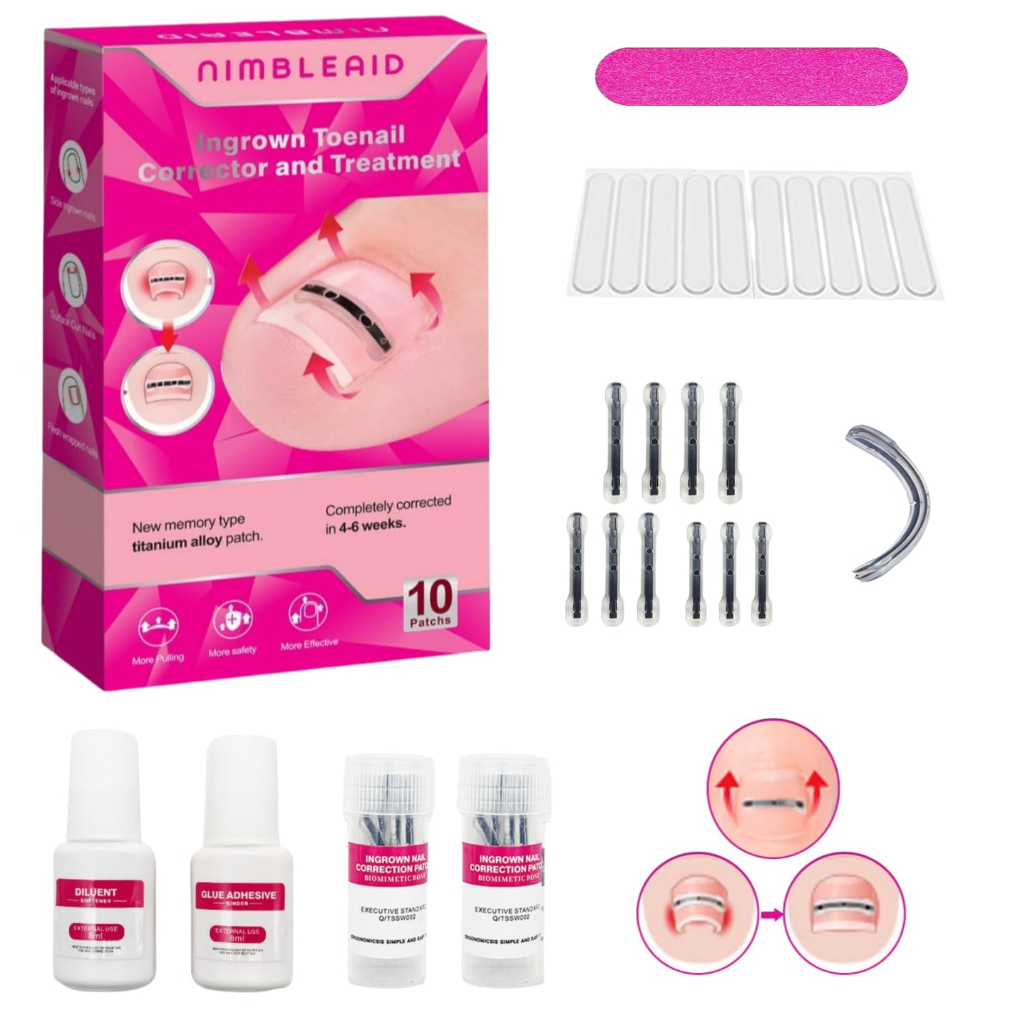 Upgraded Titanium Alloy Ingrown Toenail Corrector with Upgraded 6-Angle Shape,3x Stronger Pull Force,Ingrown Toenail Removal Kit, Ingrown Toenail Treatment for Women and Man (10101 Count (Pack of 19))