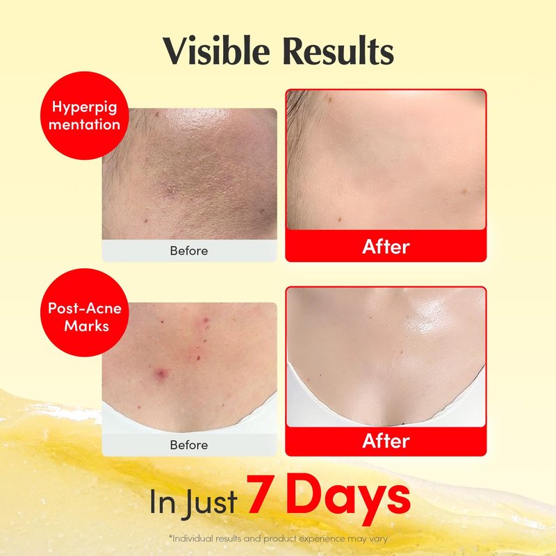 Vitamin C Illuminating Cream - 5% Niacinamide & 3% TXA | Dark Spot Treatment | Lightweight Hydration (1.69 fl. oz / 50ml)
