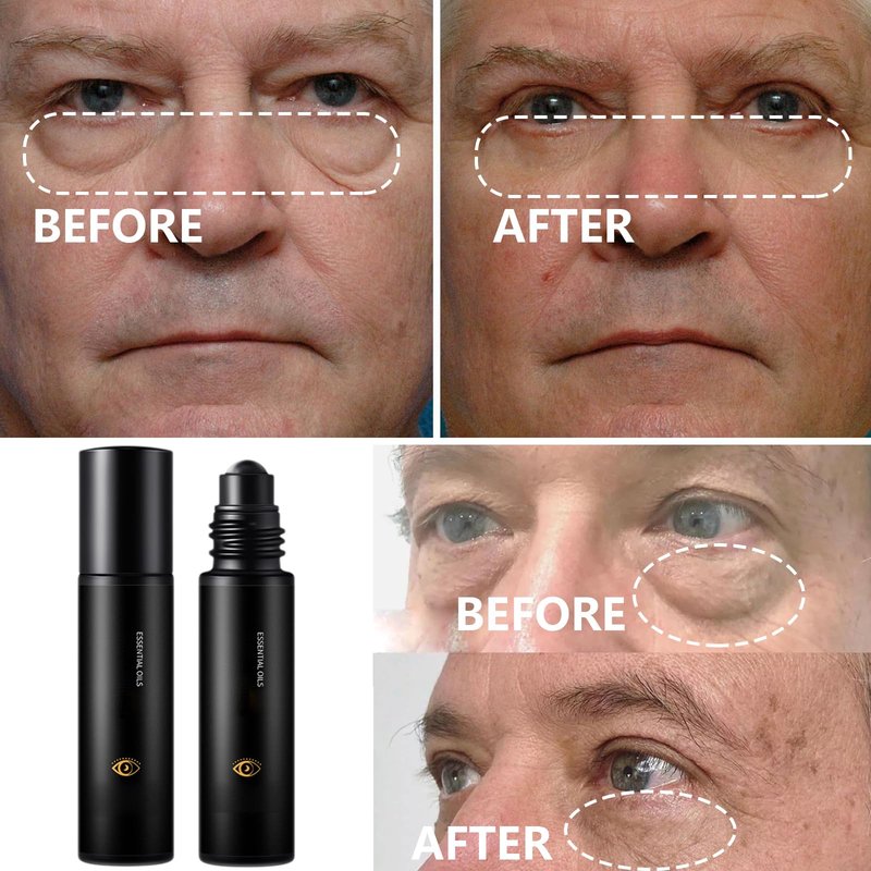 Zevorify Eye Repair Stick for Men | Caffeine Under Eye Roller for Eyebags and Dark Circles - Cooling Stick Hydrates and Depuffing, 0.34 Fl Oz (1 PC, 0.34 Fl Oz/PC)