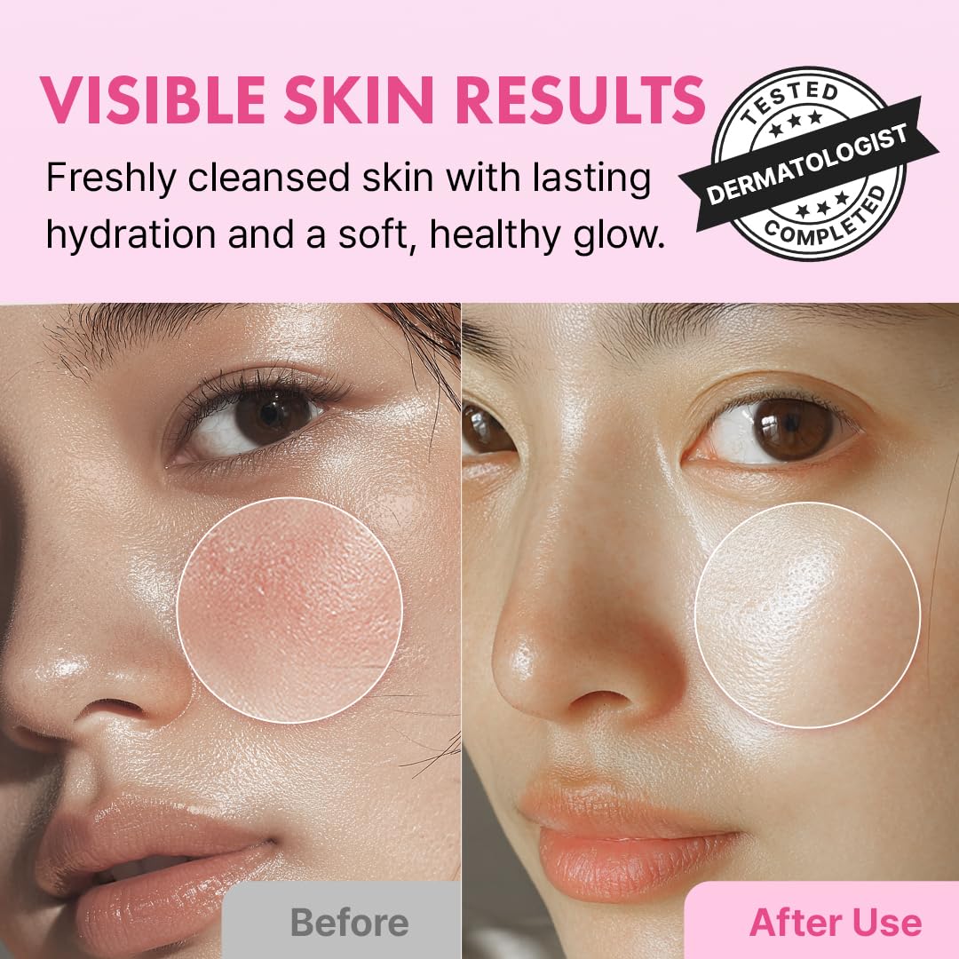 Hanskin Hyaluron Bubble Pop Cleanser – Korean Hydrating Foaming Face Wash with Hyaluronic Acid for Gentle Deep Cleansing, Softening Glow, pH-Balanced Daily Cleanser for Glass Skin | 5.07 fl oz