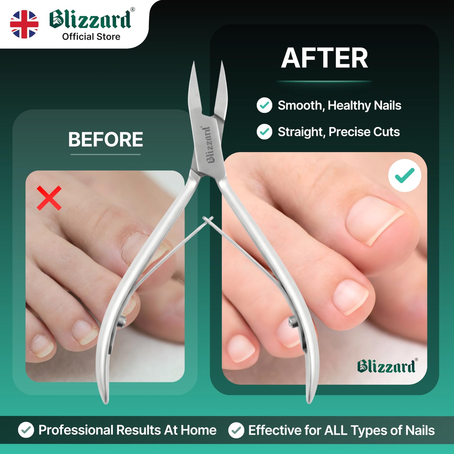 Blizzard Ingrown Toenail Clippers - Podiatrist Toenail Clippers for Thick Nails for Seniors - Ingrown Nippers for Men - German Steel Podiatry Tool with Toenail File - 13cm Arrow Head