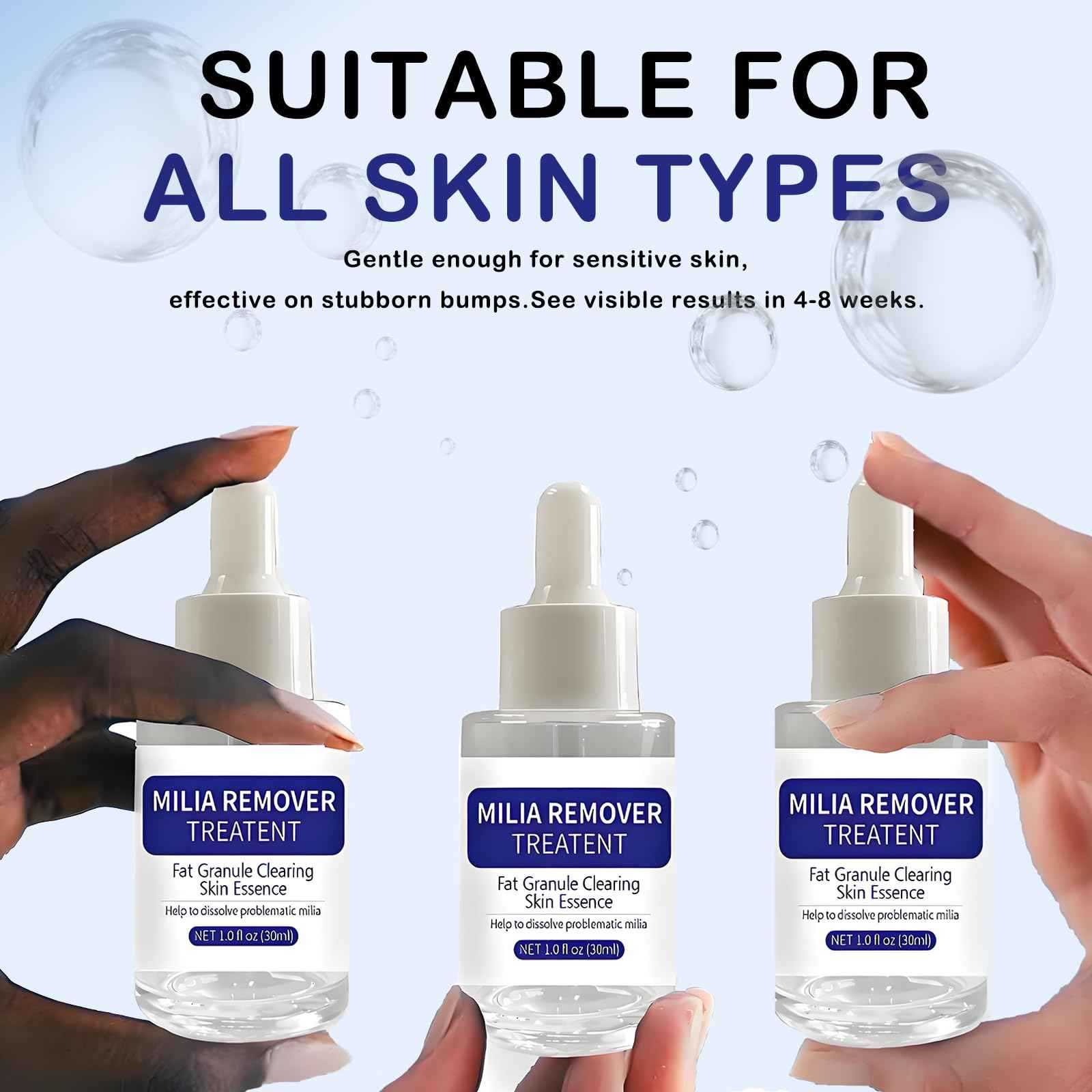 Dermfree Milia Remover Treatment, Milia Spot Treatment with Salicylic Acid Milia Acne Serum Clearing Skin Essence(30ML)