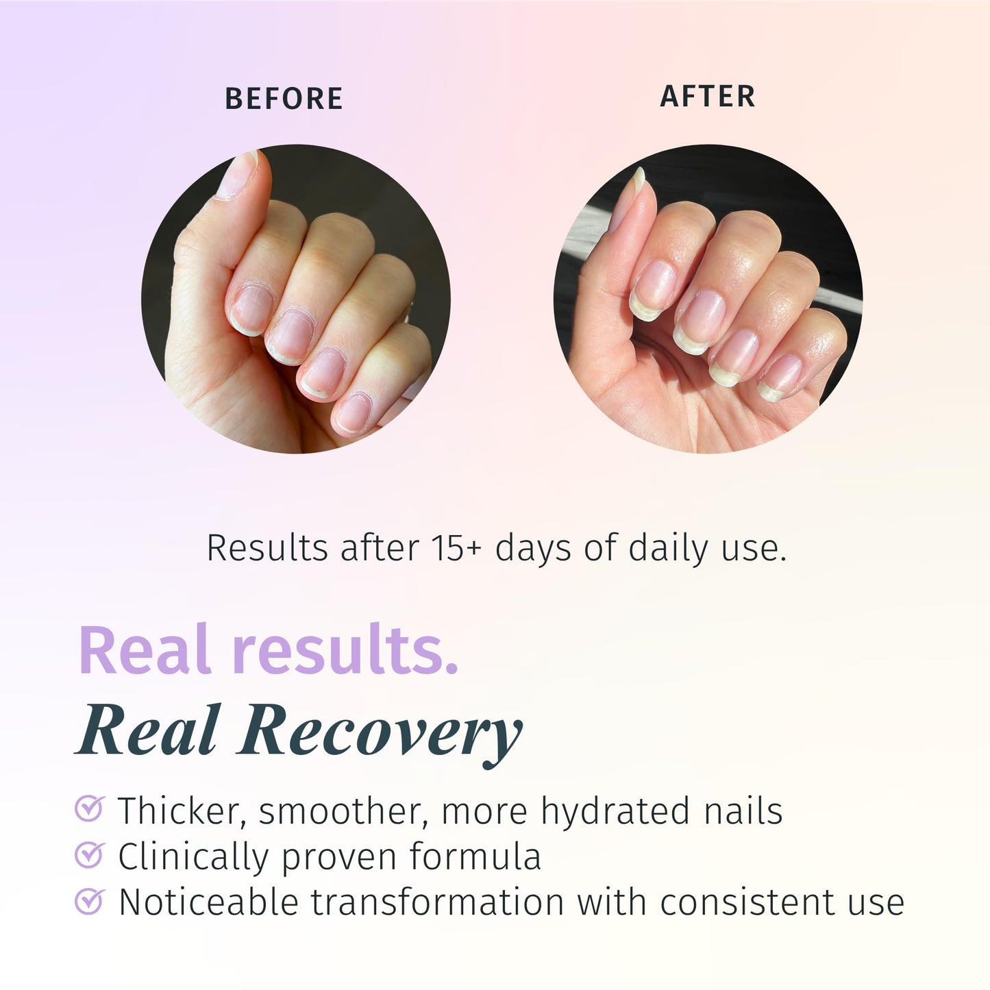 Duri Rejuvacote 2 Nail Growth Base and Top Coat, Balanced Repair - Nail Strengthening for Peeling Thin or Fragile Nails (Pack of 3)