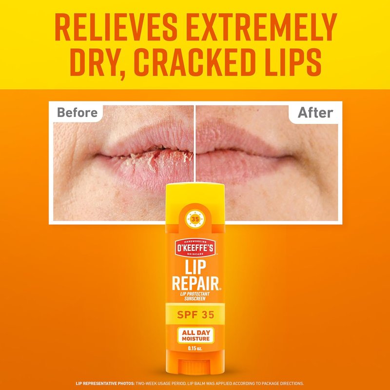 O'Keeffe's Lip Repair SPF 35 Lip Balm - 3-Pack Sun-Safe Moisturizer for Extremely Dry Lips