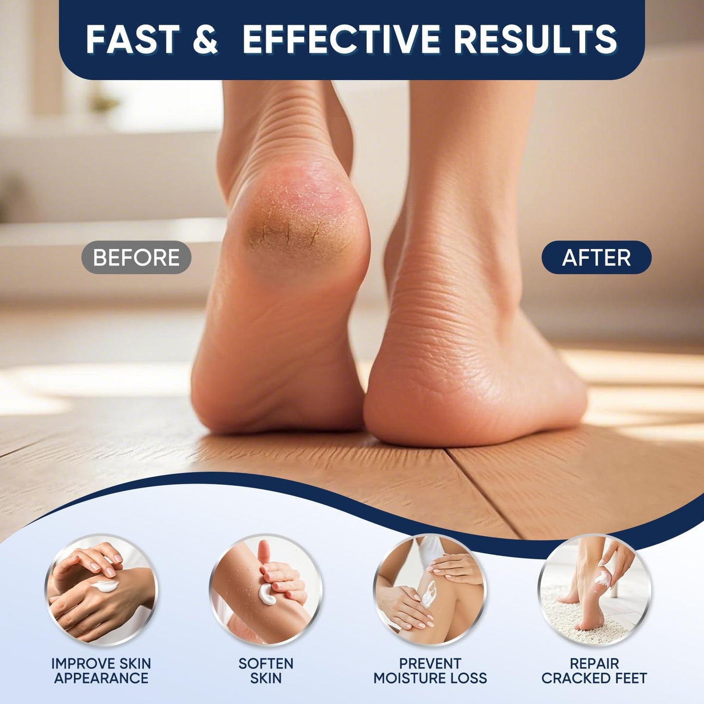 VREKEF Urea Cream 60% with 2% Salicylic Acid, Urea Cream 60 Percent for Feet Maximum Strength, Foot Cream & Callus Remover for Dry Cracked Heels, Rough Thick Skin, Deep Hydration, 5.29 oz