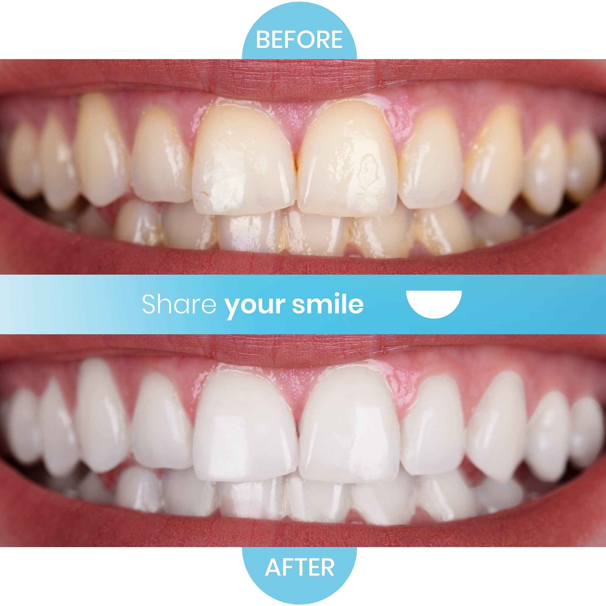 Purean Teeth Whitening Oxystrips - 40 Pure Atomic Oxygen Releasing White Strips - 20 Treatments