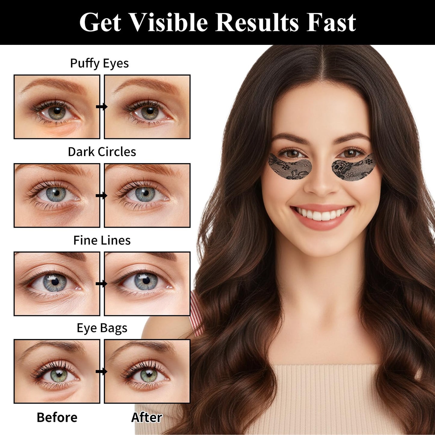 SPRINGSKY Under Eye Patches,Lace Eye Mask for Puffy Eyes and Dark Circles,Collagen Skin Care Products,Hydrating,Smoothing,Anti-Aging Eye Patch for Under Eye Bags（24 Pairs）