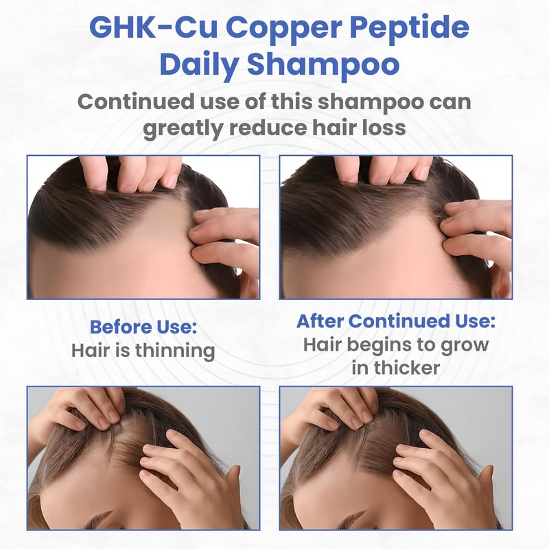 Copper Peptide Shampoo - Anti Hair Loss Shampoo - Promotes New Hair Growth