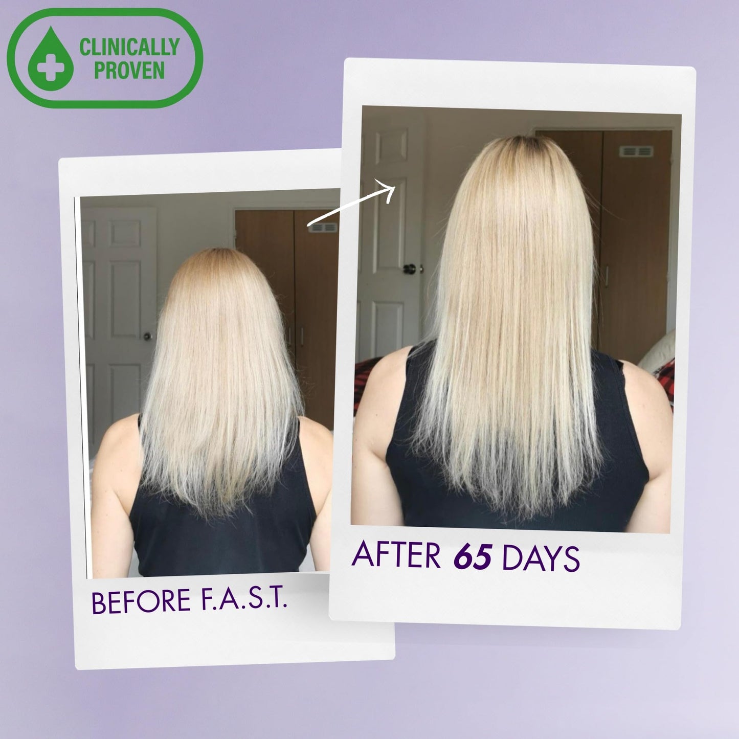 Hair Growth Shampoo & Conditioner Duo — Clinically Proven — Helps Grow Hair 99% Faster in 12 weeks— Biotin, Niacinamide & 8 Amino Acids — All Hair Types, For Long, Beautiful & Healthy Hair