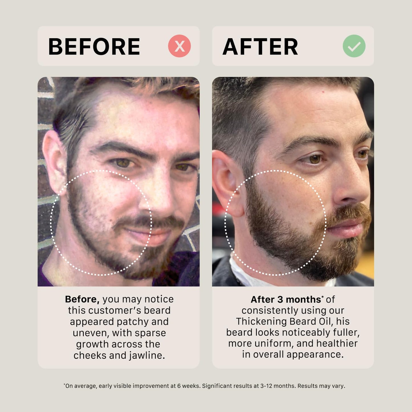 ACTIIV Thickening Beard Oil (Unscented) | Promotes Thicker Fuller Beard Growth, Nourishes & Softens Facial Hair, Lightweight Non-Greasy Formula, Vegan, Plant-Based, All Beard Types, 30 mL / 1 oz