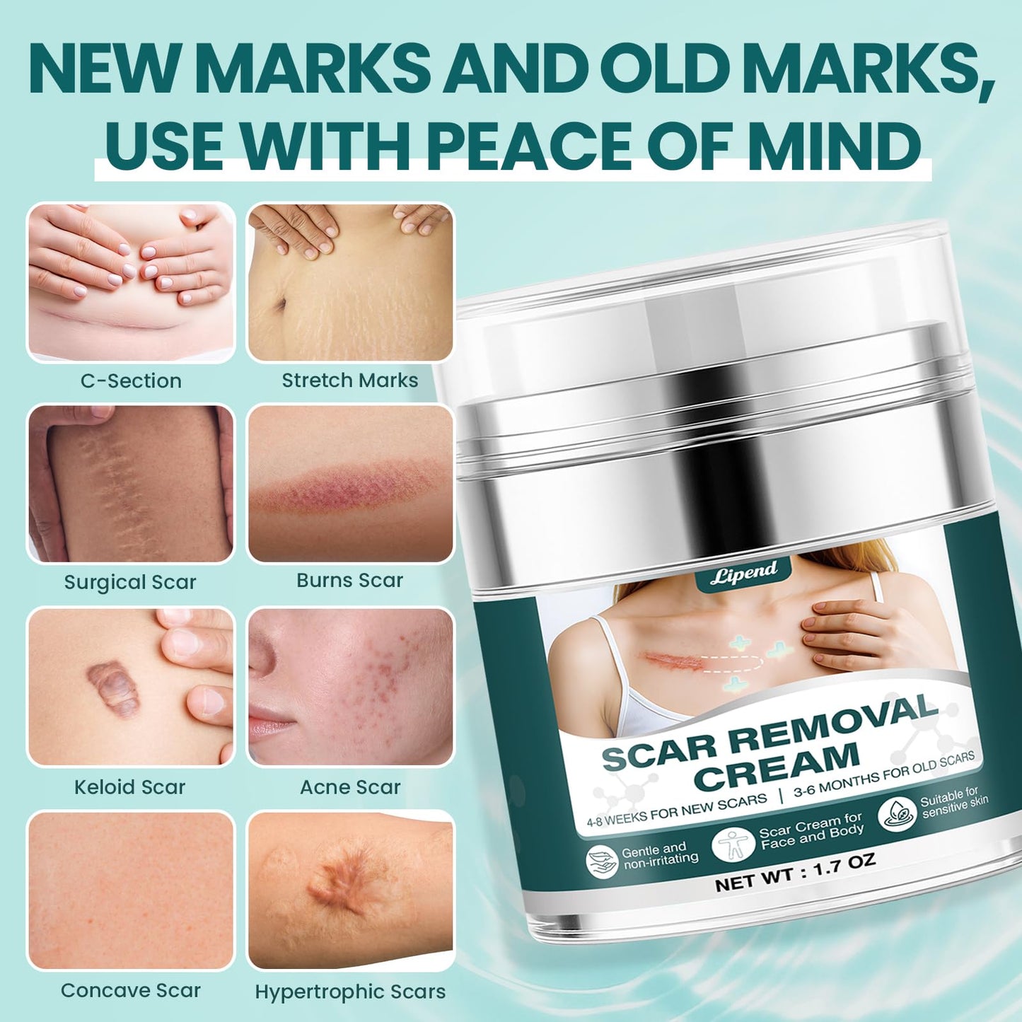 Scar Cream Gel Silicone Removal for Surgical Scars Burn Old Scars Acne Face Stretch Marks Hypertrophic Keloid wait Silicone Gel For Scars Topical Remover 2Pack 1.7 Oz