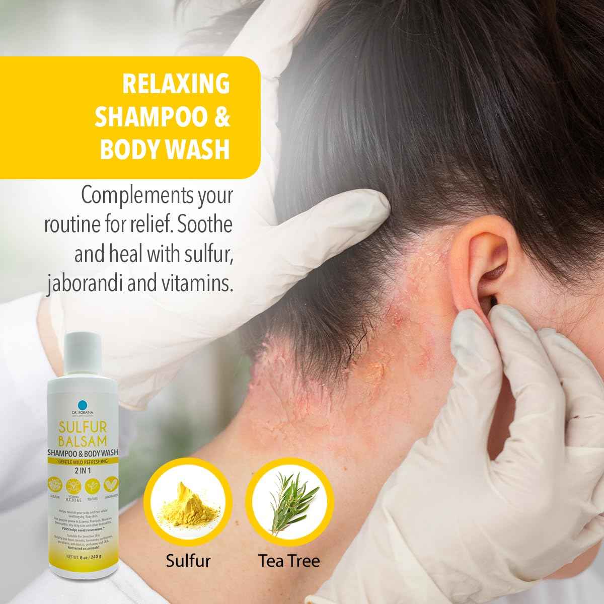 Dr. Robaina Sulfur Shampoo & Body Wash – Helps Soothe Dandruff, Seborrheic Dermatitis, Folliculitis & Itchy Scalp – Color-Safe, SLS-Free, Citrus-Mint Scent, 8 fl oz - Made in the USA