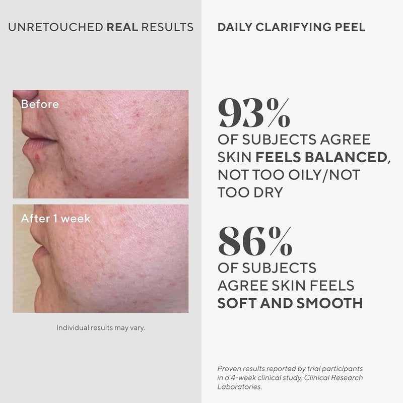 Murad Daily Clarifying Peel - AHA/BHA Exfoliating Liquid with Retinoid & Salicylic Acid | 3.2 Fl Oz