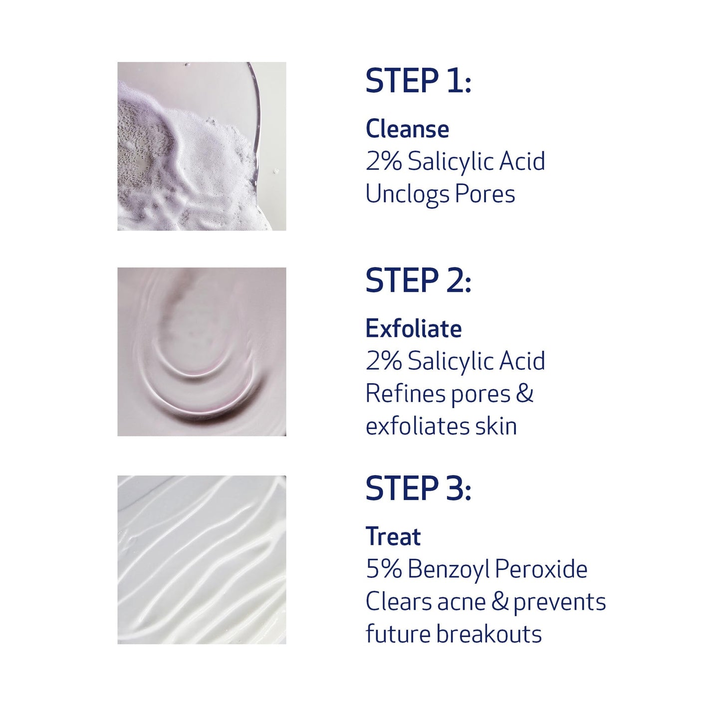 Obagi CLENZIderm M.D. Therapeutic System – 3 Step Acne Treatment System Includes 2% Salicylic Acid (BHA) Cleanser, 2% Salicylic Acid (BHA) Exfoliating Toner, 5% Benzoyl Peroxide (BPO) Acne Treatment